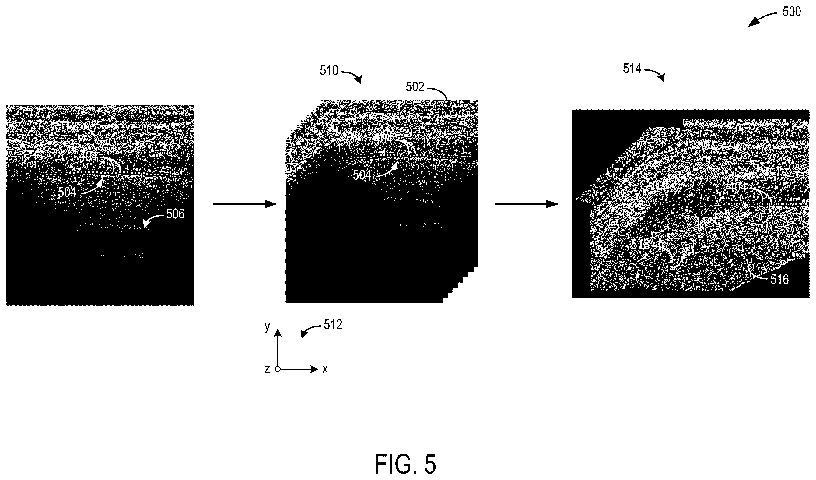 Patent US12599367 Figure 5 – Methods and systems for generating 3D pleural surfaces