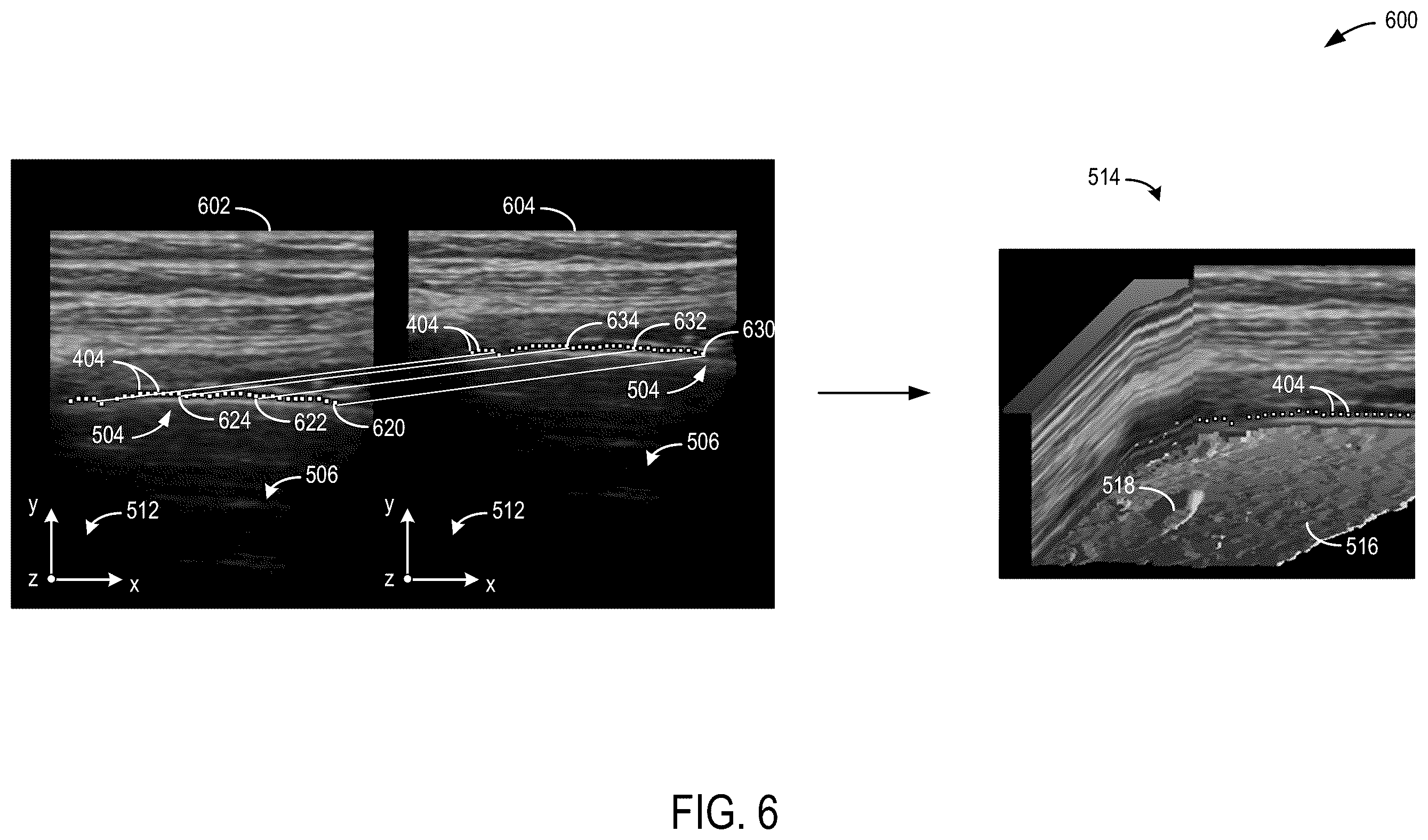 Patent US12599367 Figure 6 – Methods and systems for generating 3D pleural surfaces