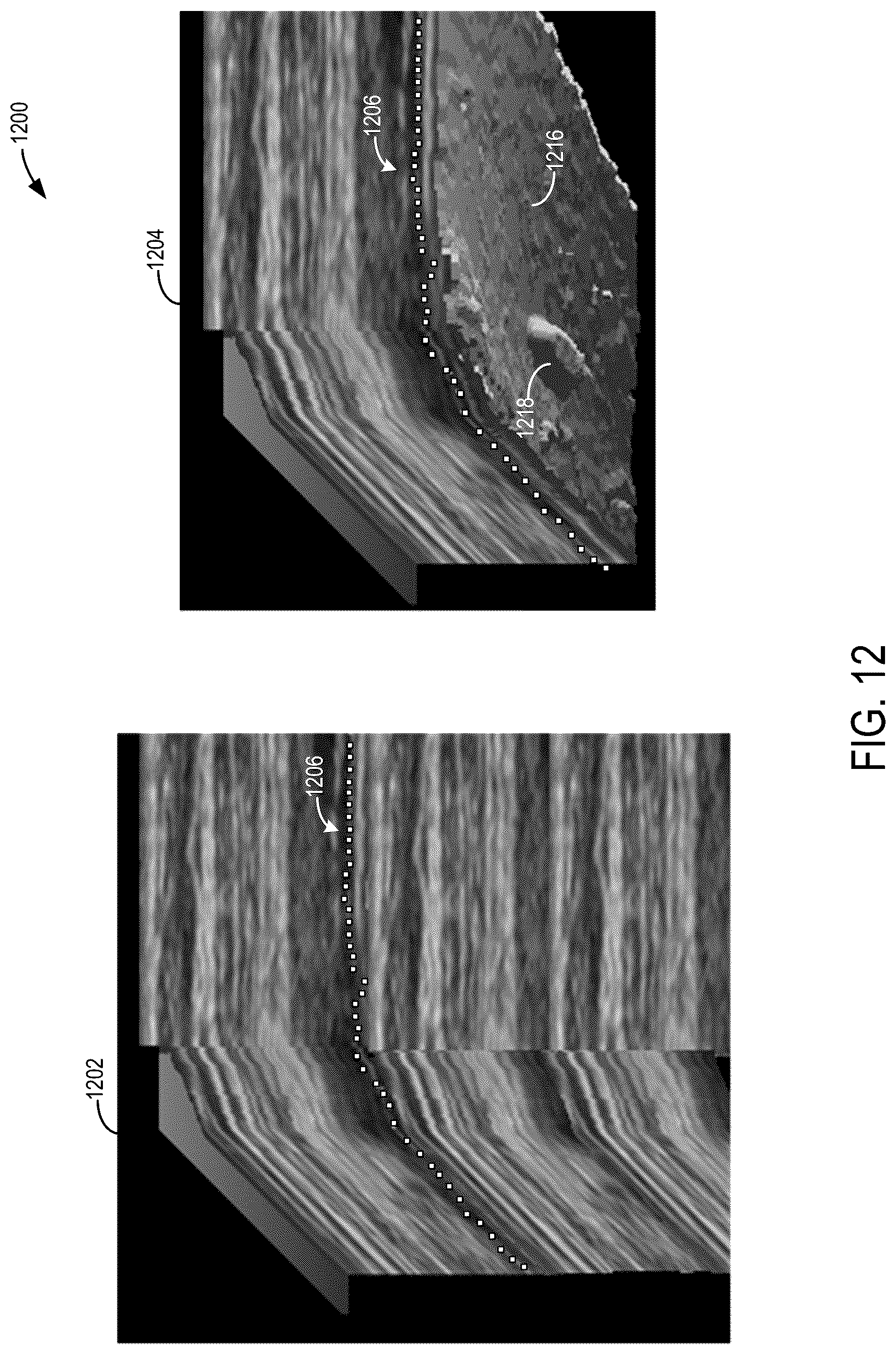 Patent US12599367 Figure 12 – Methods and systems for generating 3D pleural surfaces