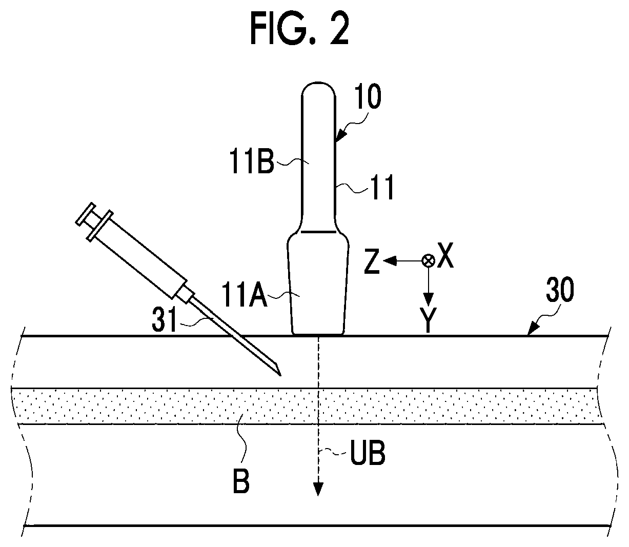 Patent US12599368 Figure 2 – Information processing apparatus, information processing method, and program
