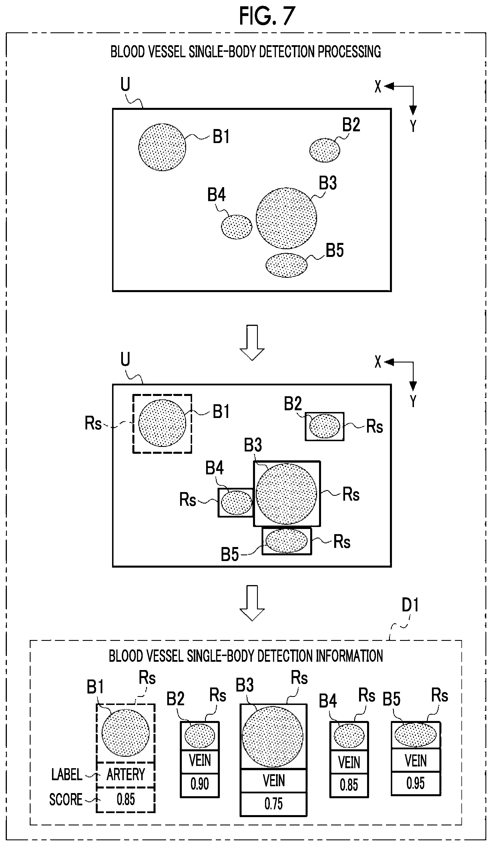 Patent US12599368 Figure 5 – Information processing apparatus, information processing method, and program