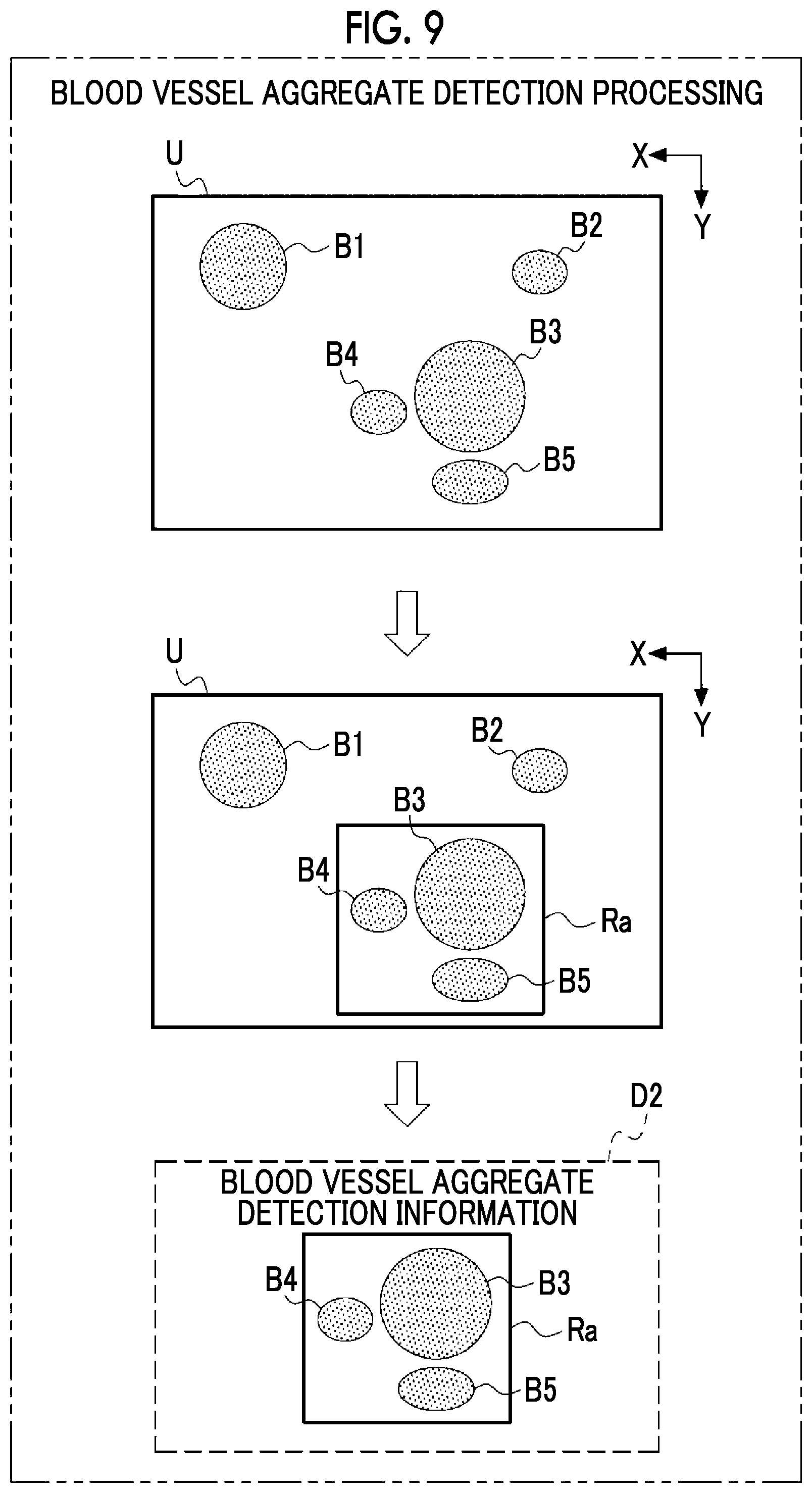 Patent US12599368 Figure 7 – Information processing apparatus, information processing method, and program
