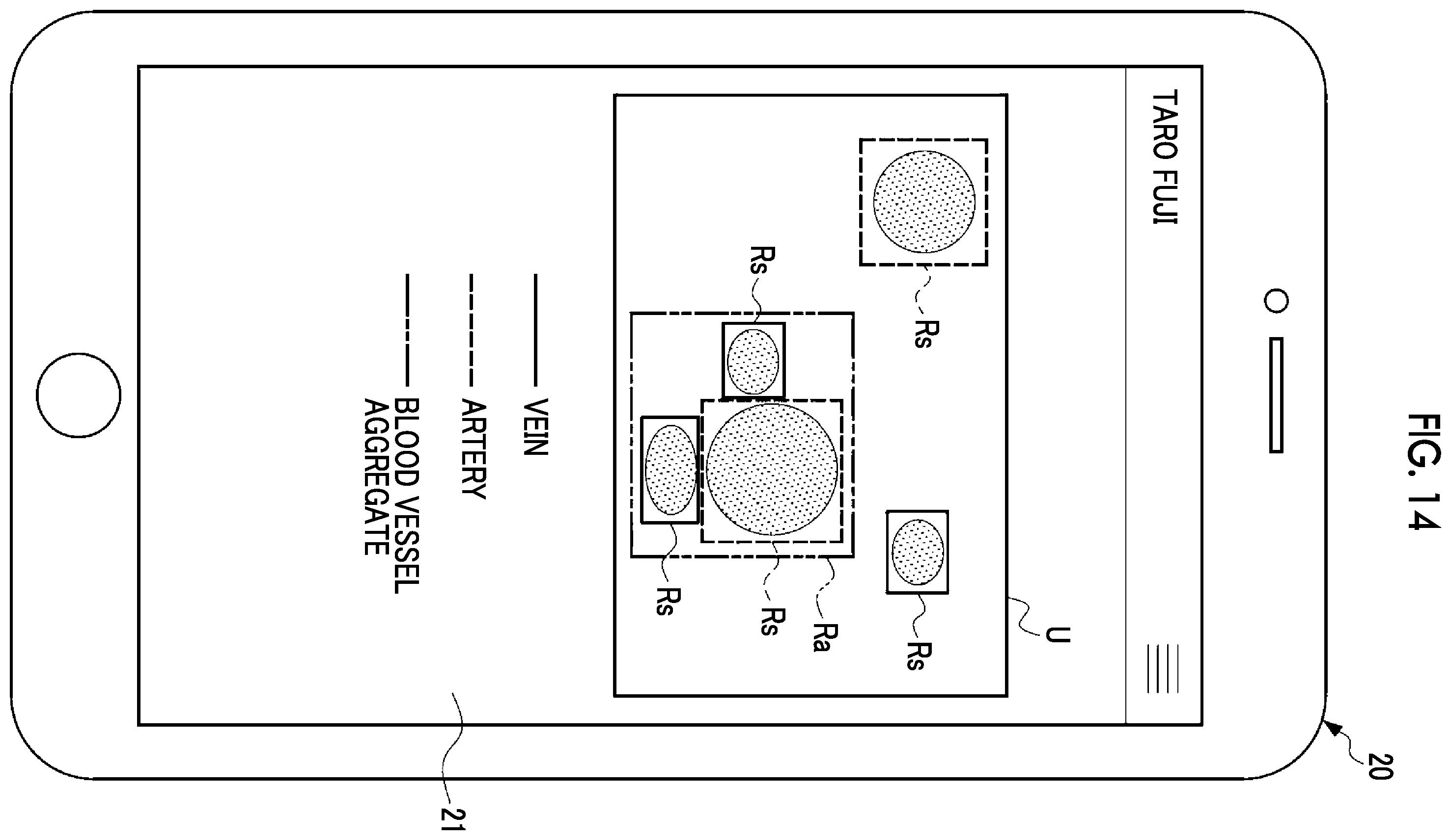 Patent US12599368 Figure 11 – Information processing apparatus, information processing method, and program