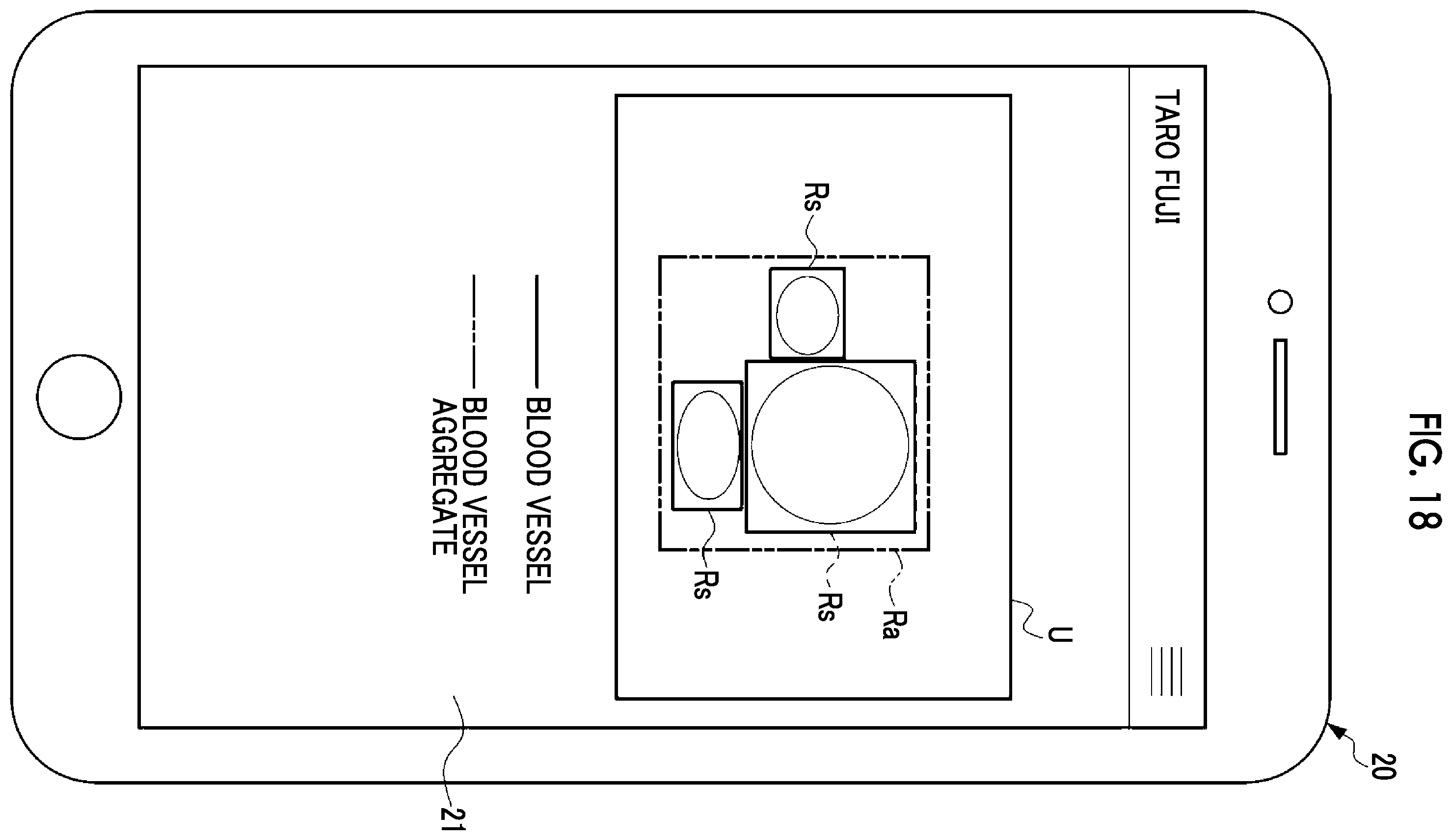 Patent US12599368 Figure 14 – Information processing apparatus, information processing method, and program