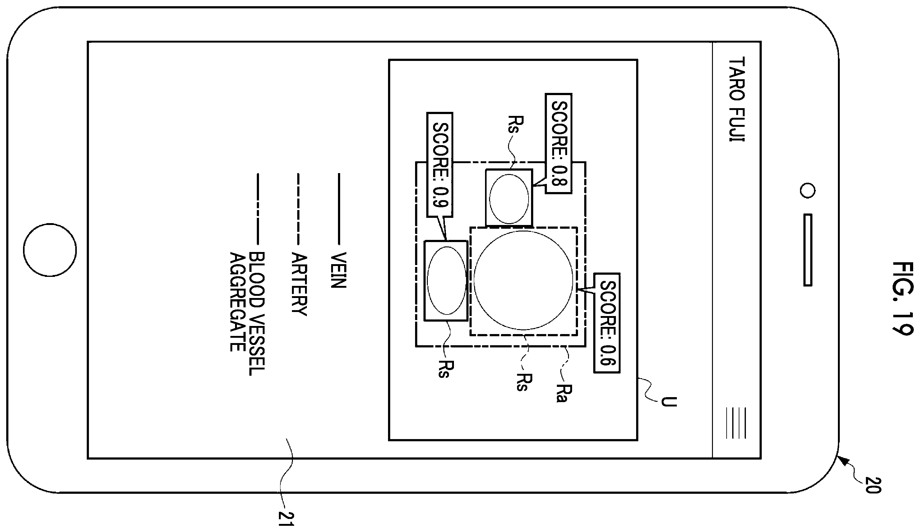 Patent US12599368 Figure 15 – Information processing apparatus, information processing method, and program