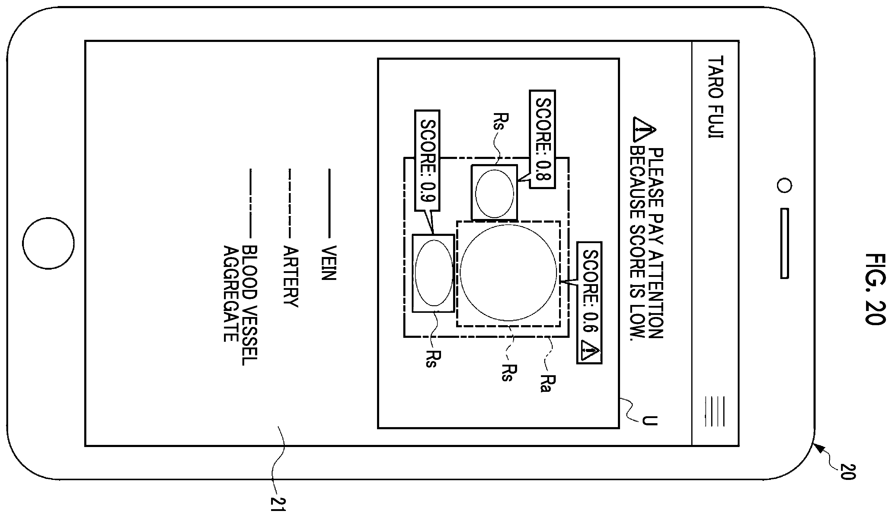 Patent US12599368 Figure 16 – Information processing apparatus, information processing method, and program