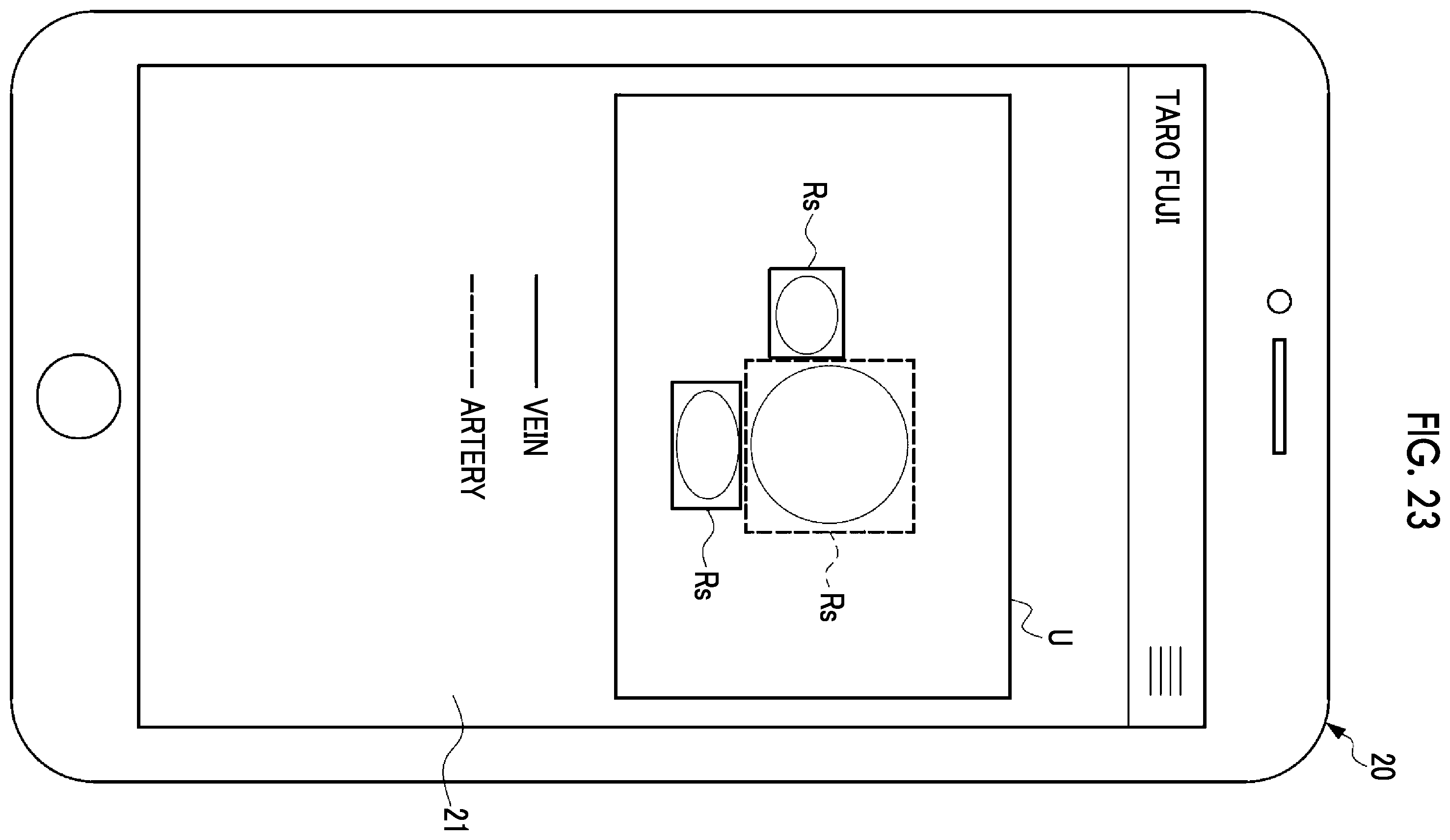 Patent US12599368 Figure 18 – Information processing apparatus, information processing method, and program