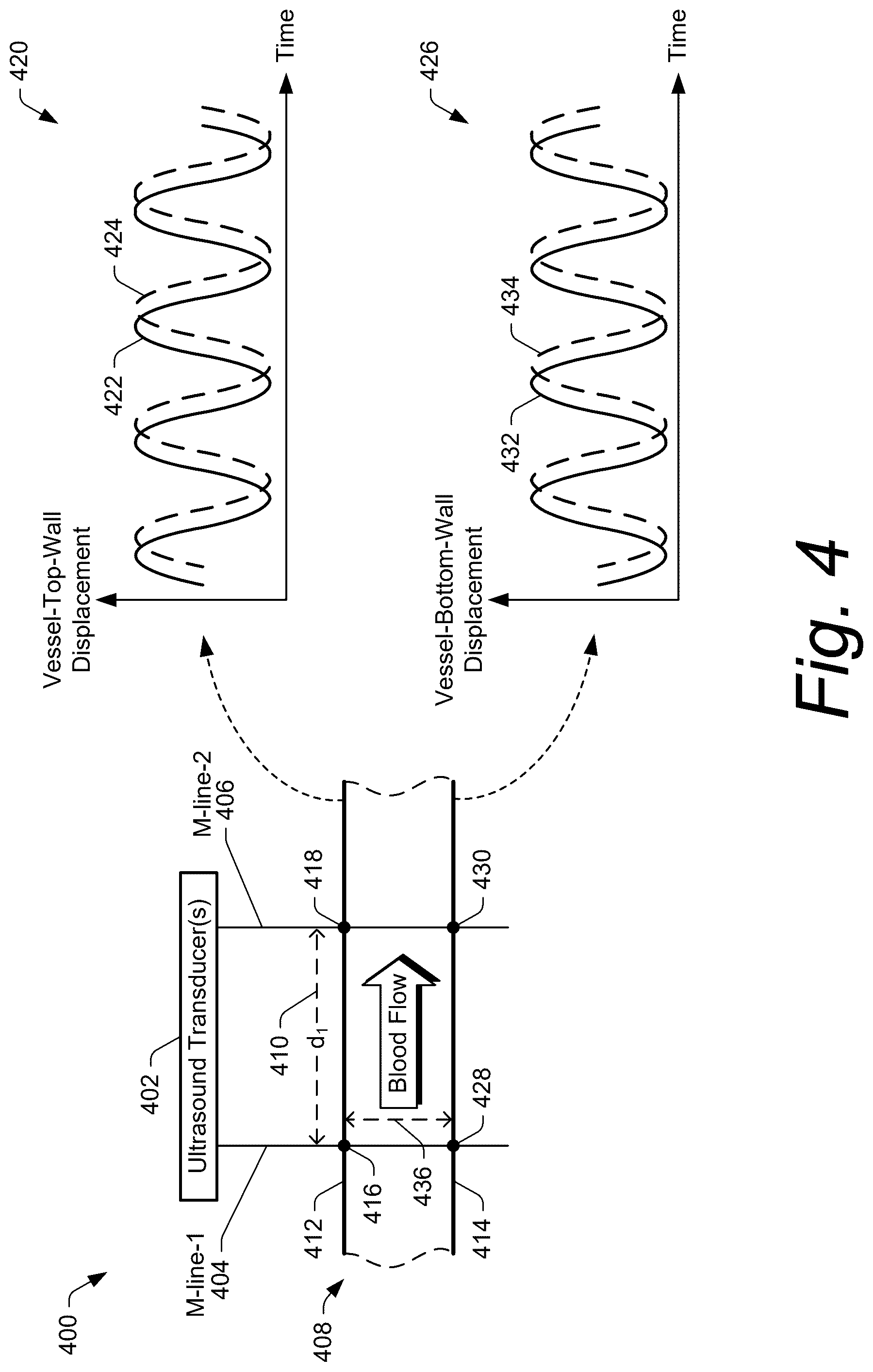 Patent US12599369 Figure 4 – Ultrasound methods and systems for measuring physiological properties
