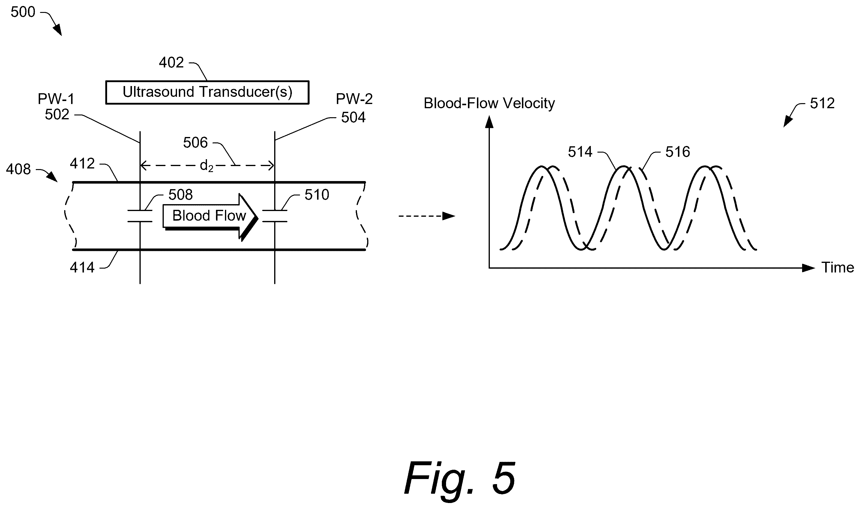 Patent US12599369 Figure 5 – Ultrasound methods and systems for measuring physiological properties