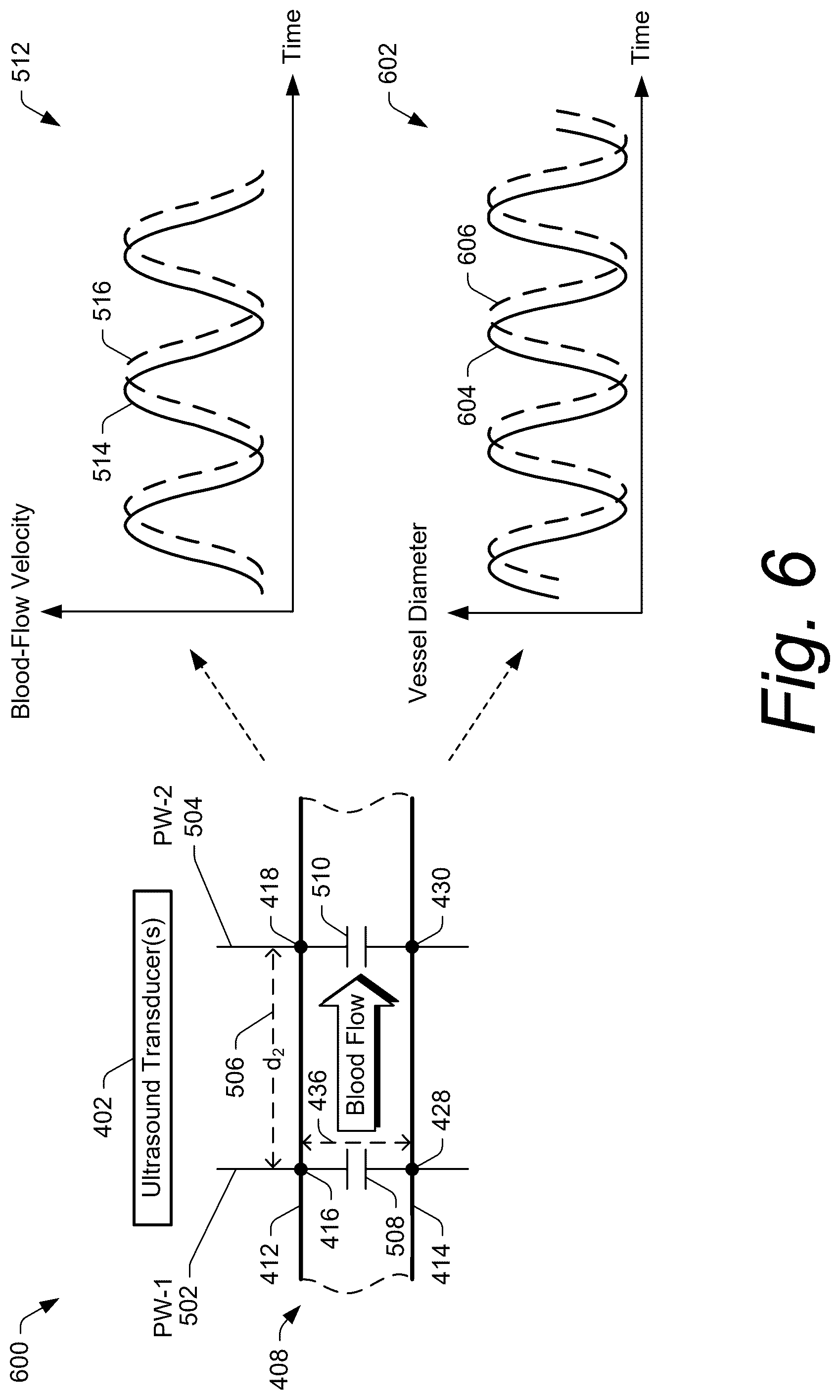 Patent US12599369 Figure 6 – Ultrasound methods and systems for measuring physiological properties