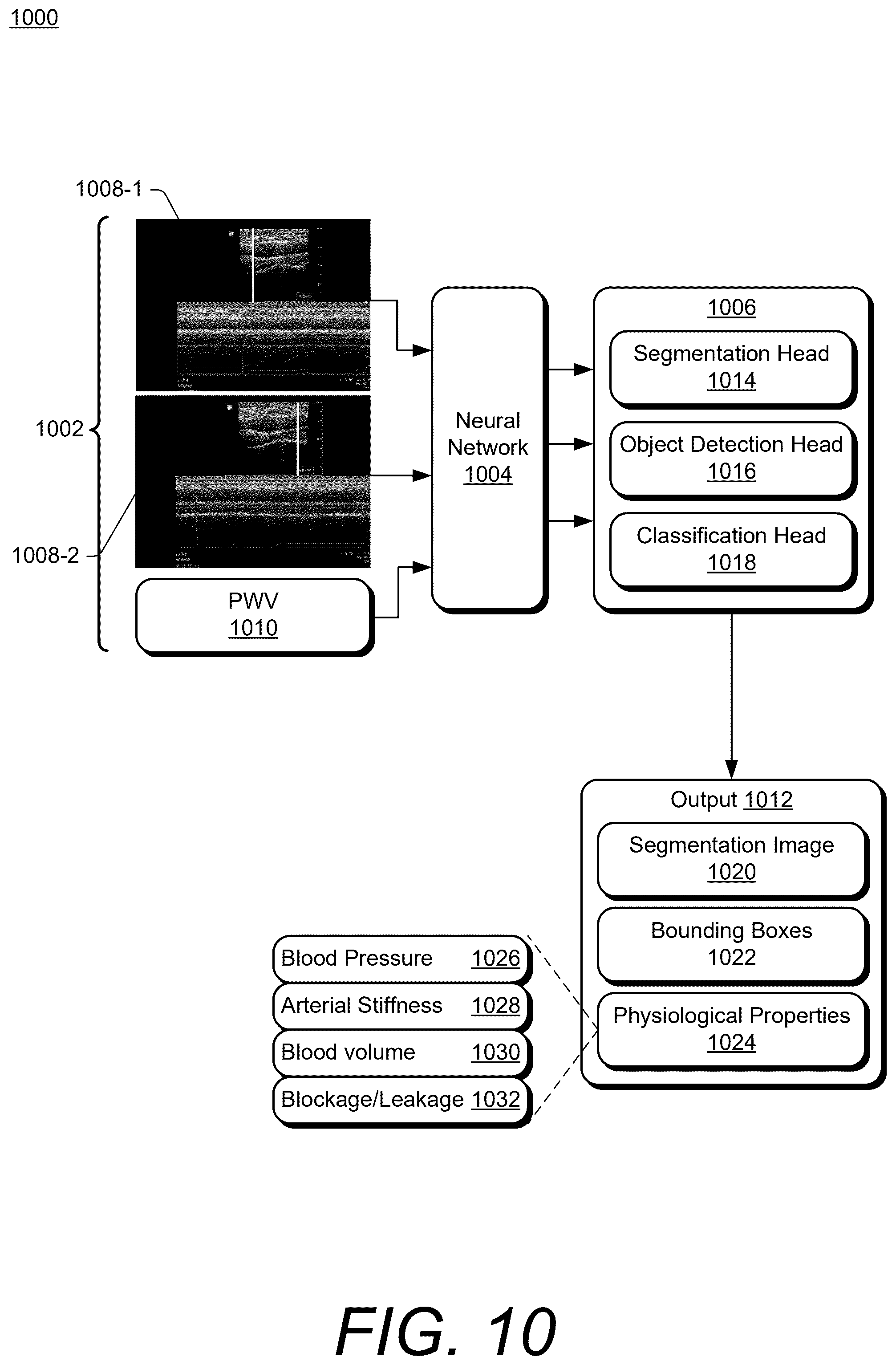 Patent US12599369 Figure 10 – Ultrasound methods and systems for measuring physiological properties