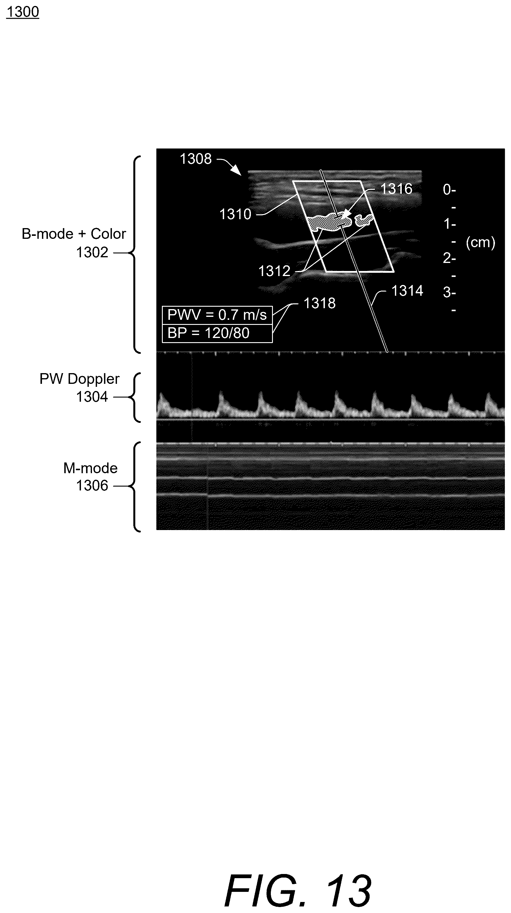 Patent US12599369 Figure 13 – Ultrasound methods and systems for measuring physiological properties