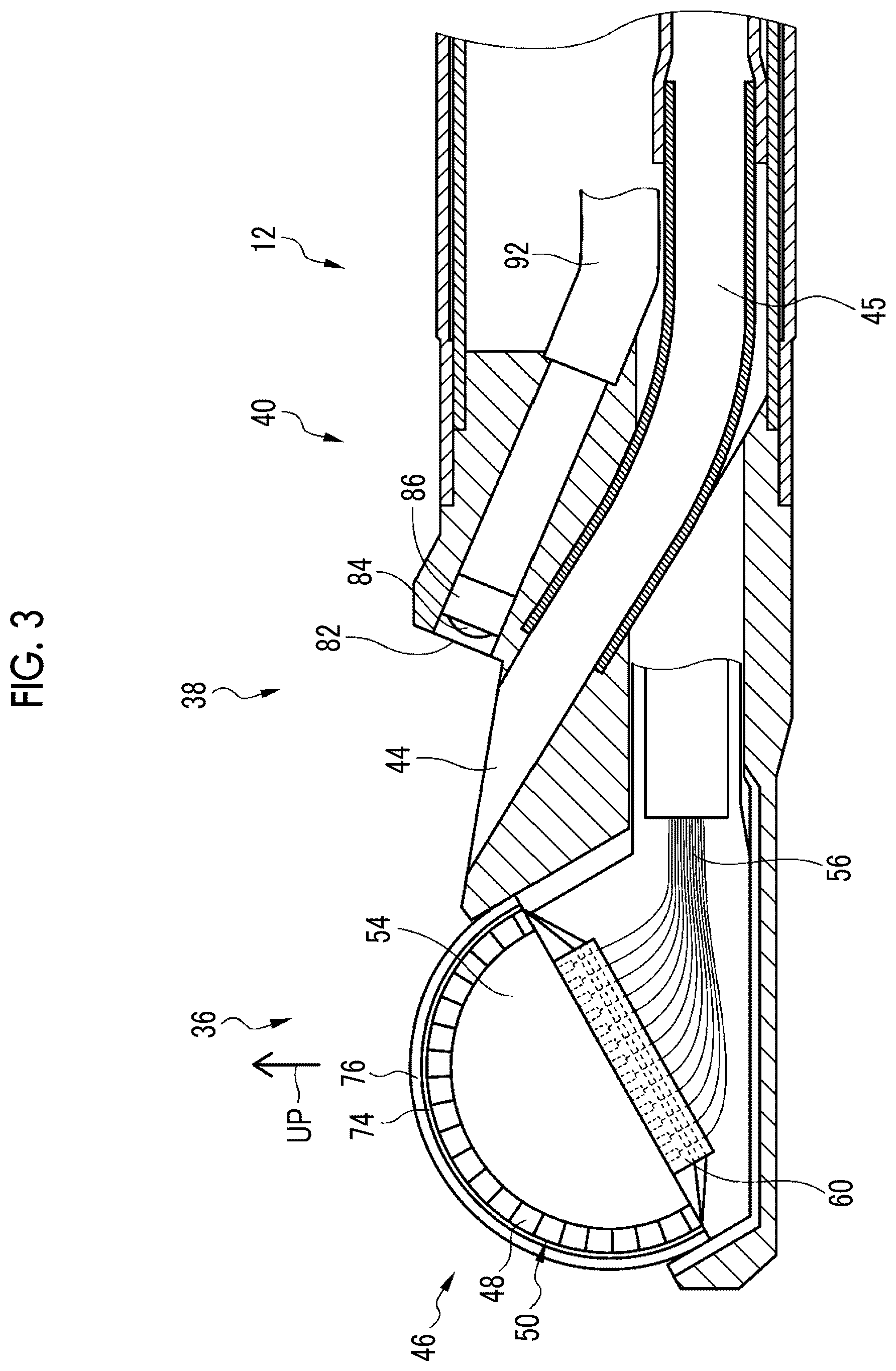 Patent US12599370 Figure 3 – Ultrasound diagnostic system