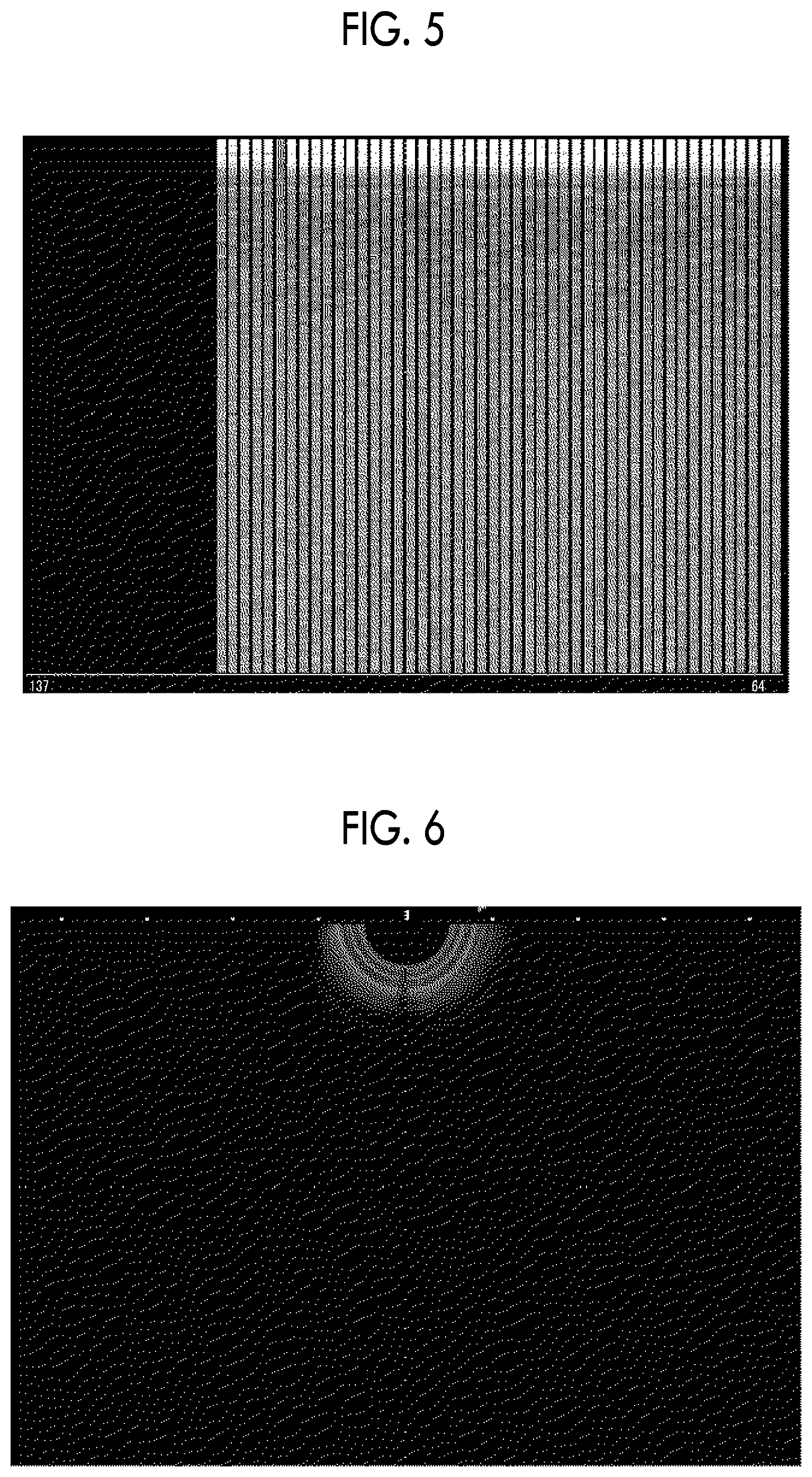 Patent US12599370 Figure 5 – Ultrasound diagnostic system