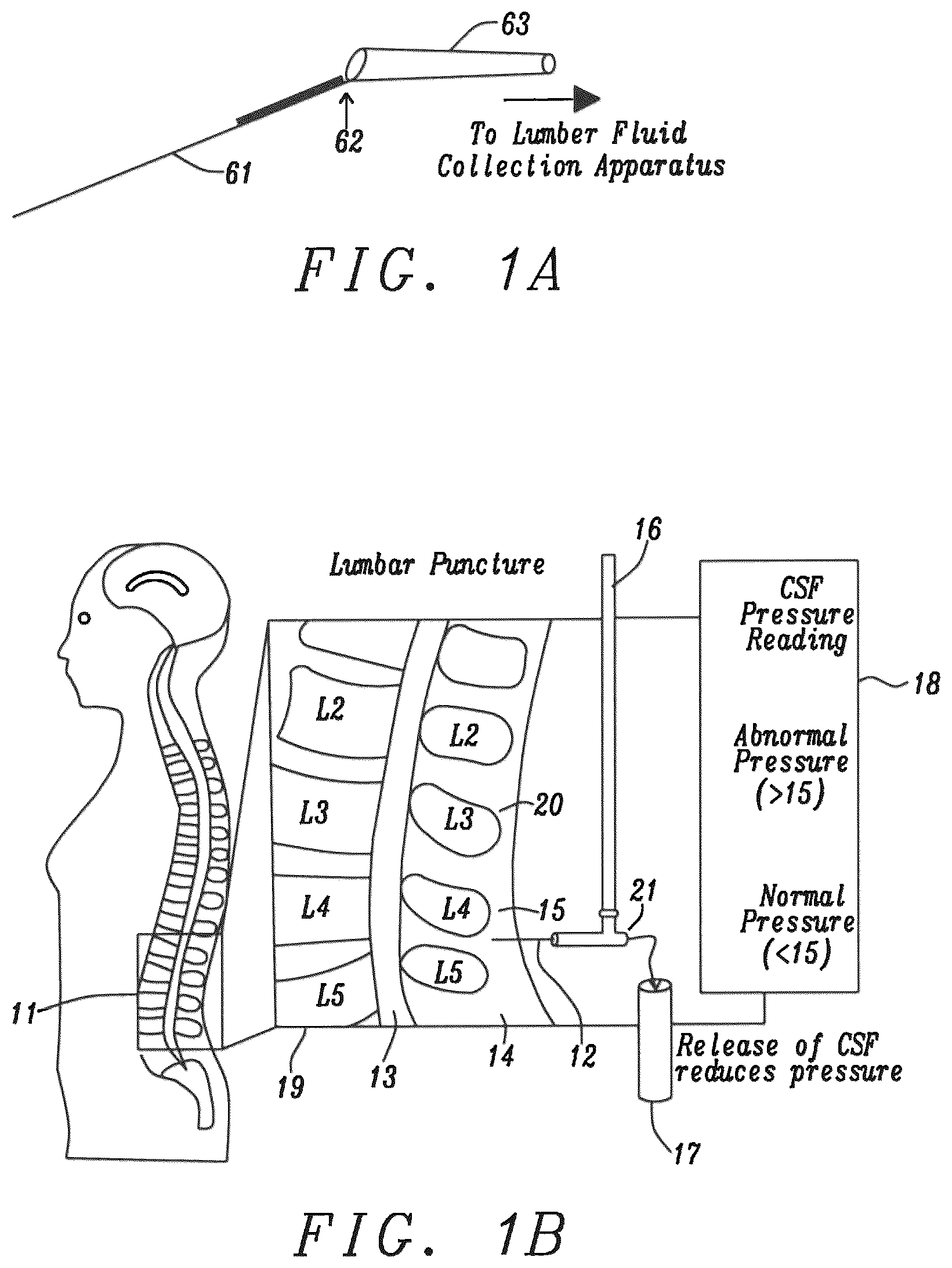 Patent US12599372 Figure 1 – Lumbar puncture locator device