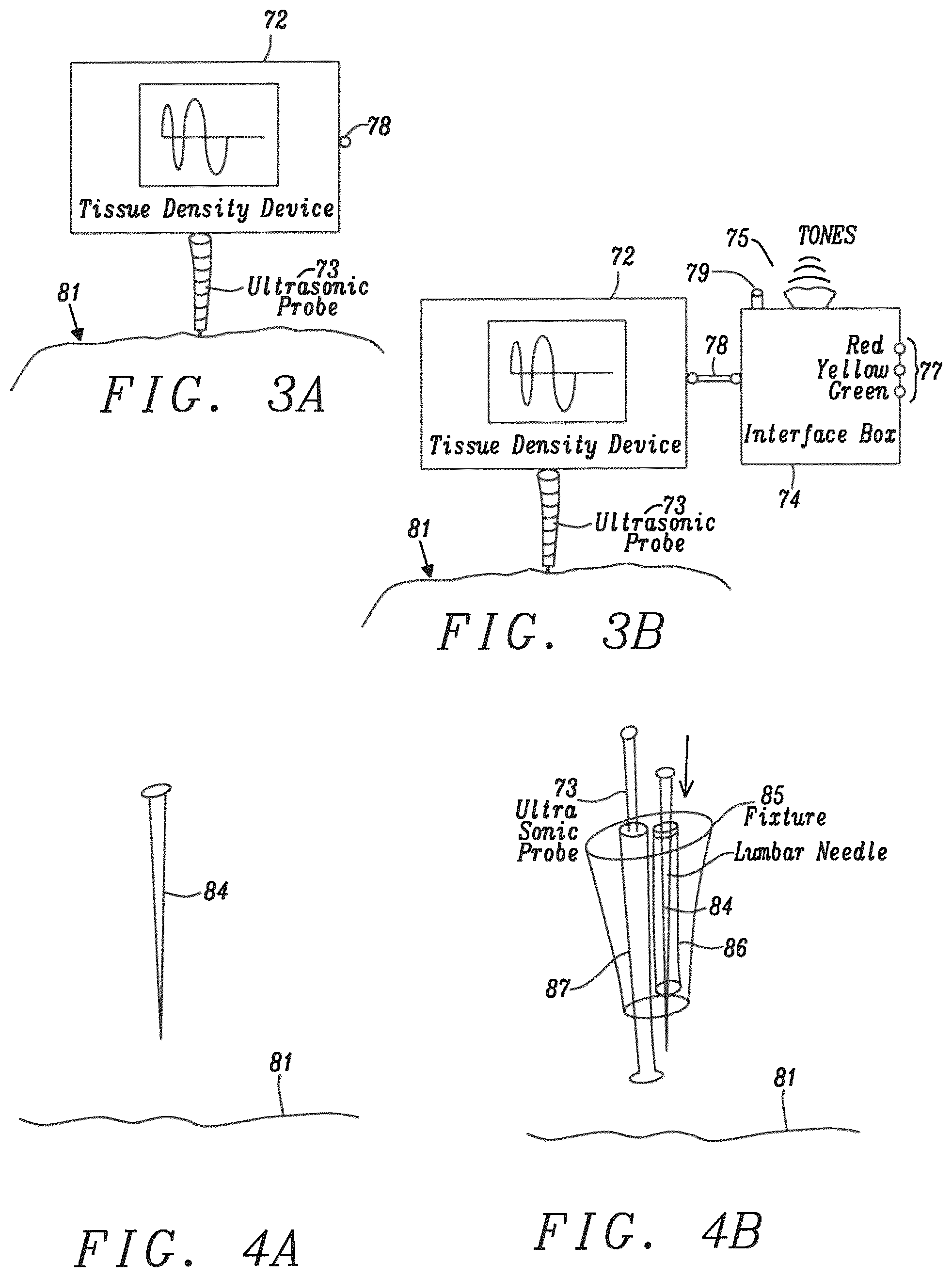 Patent US12599372 Figure 4 – Lumbar puncture locator device