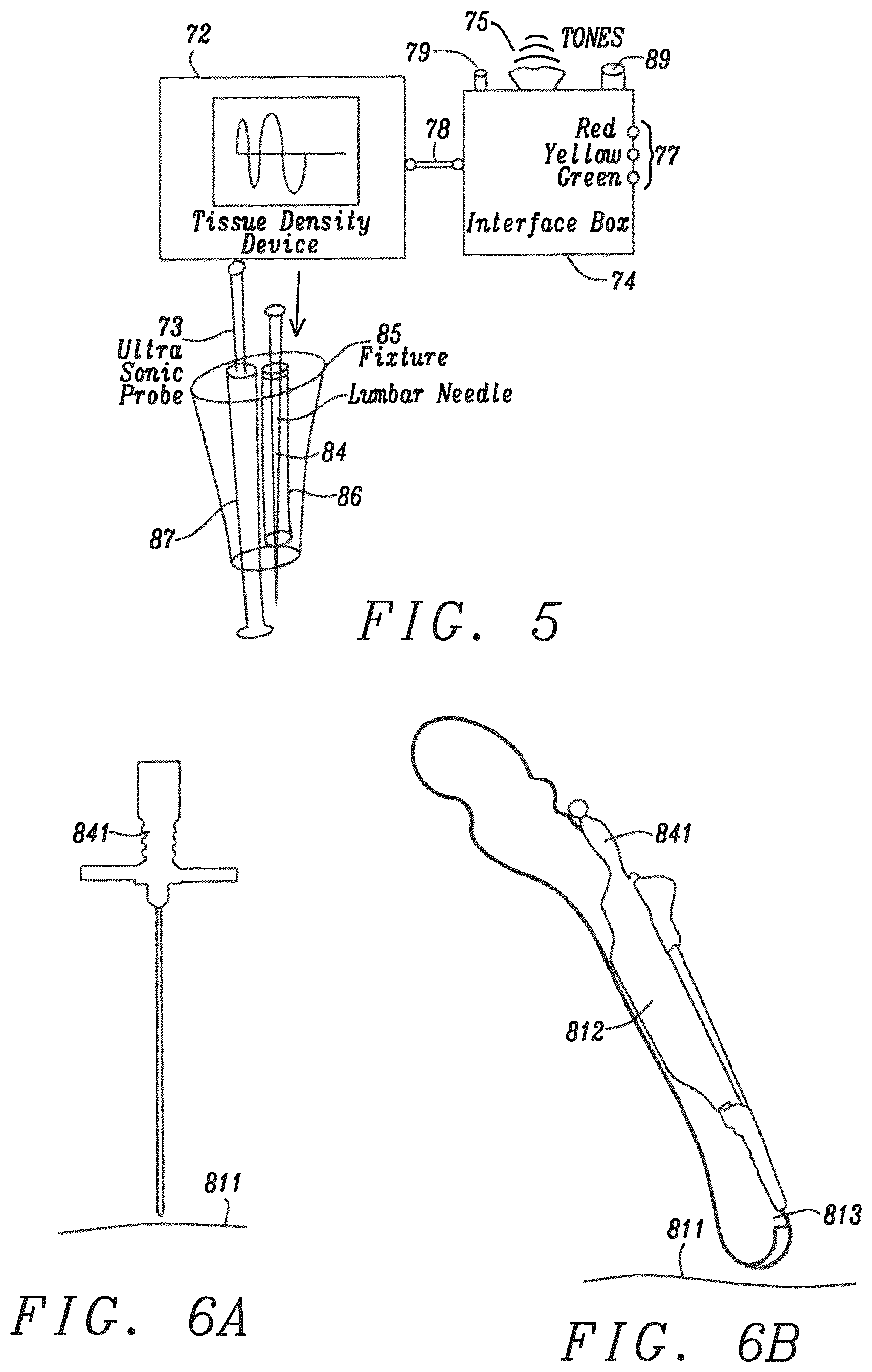 Patent US12599372 Figure 5 – Lumbar puncture locator device