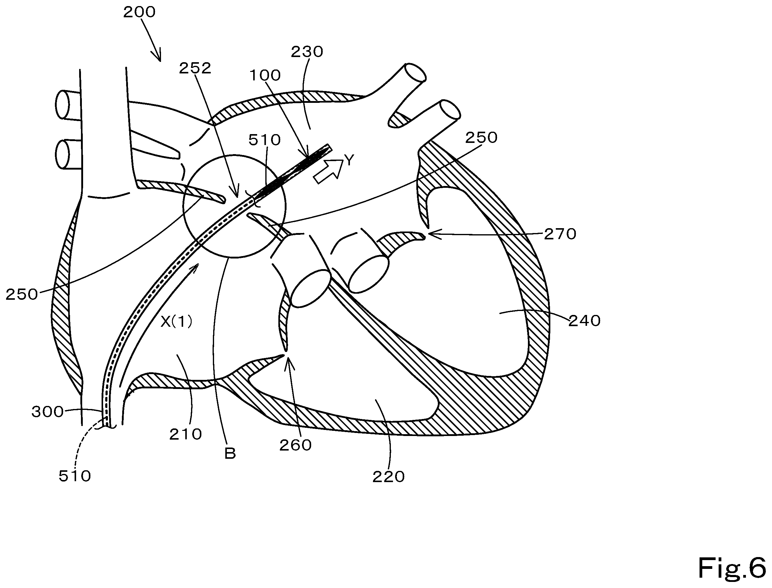 Patent US12599375 Figure 7 – Medical material