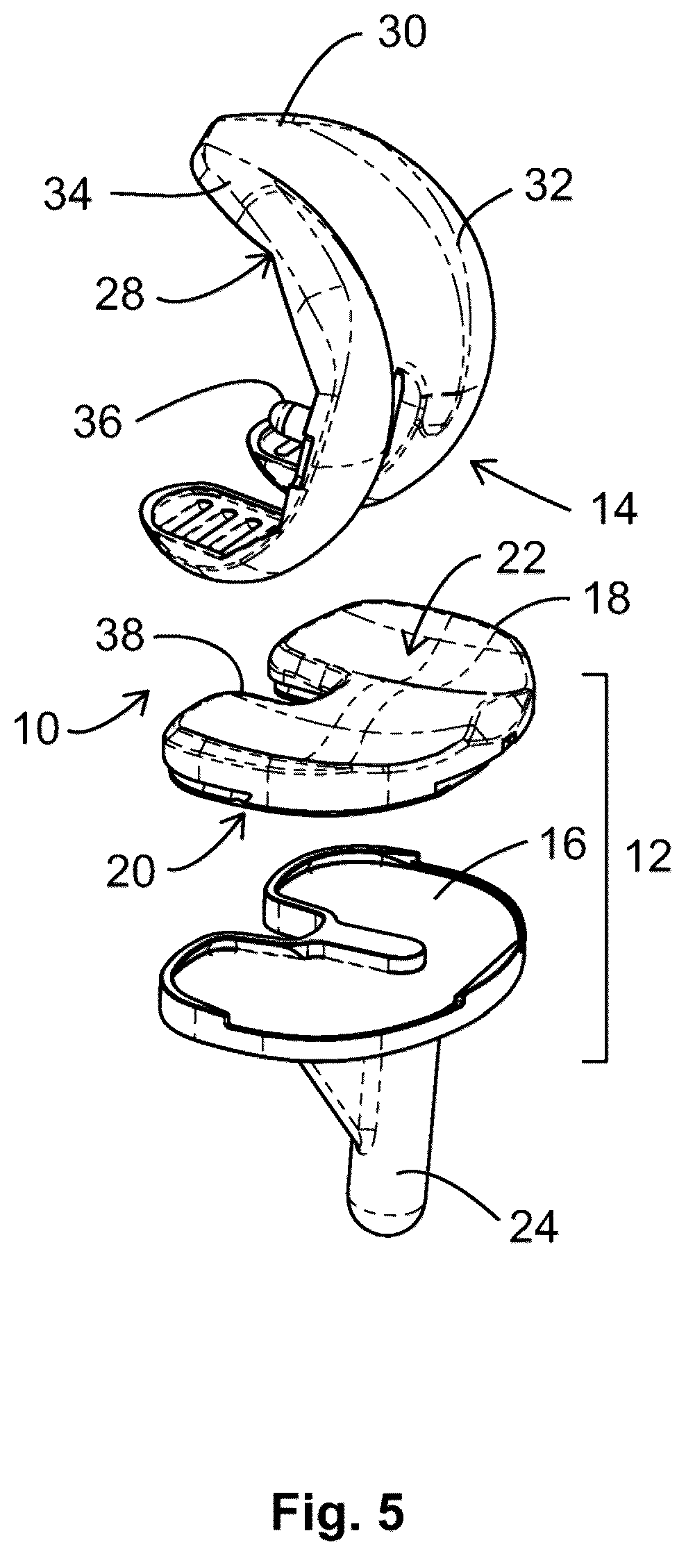 Patent US12599377 Figure 3 – Knee tensioner-balancer and method