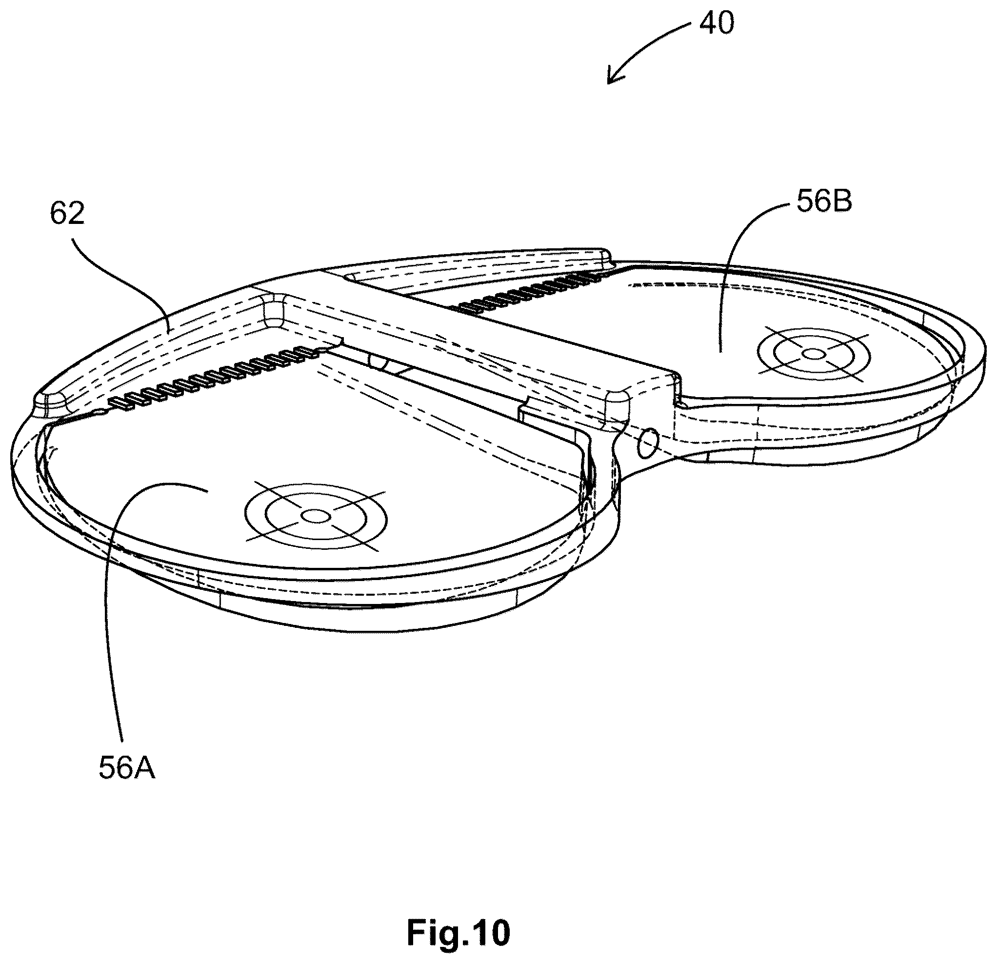Patent US12599377 Figure 6 – Knee tensioner-balancer and method