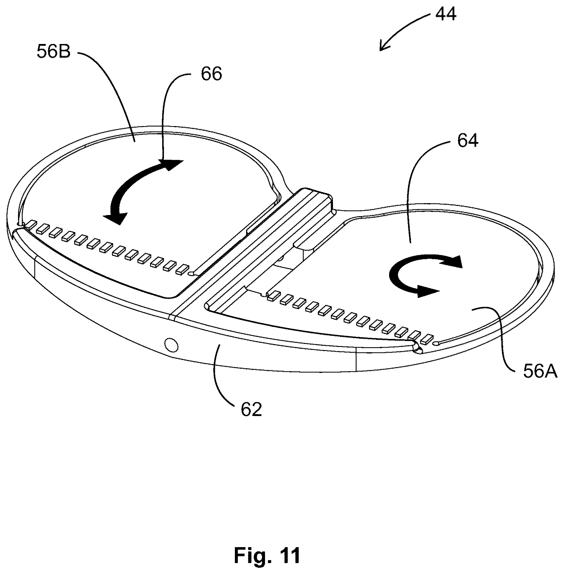 Patent US12599377 Figure 7 – Knee tensioner-balancer and method