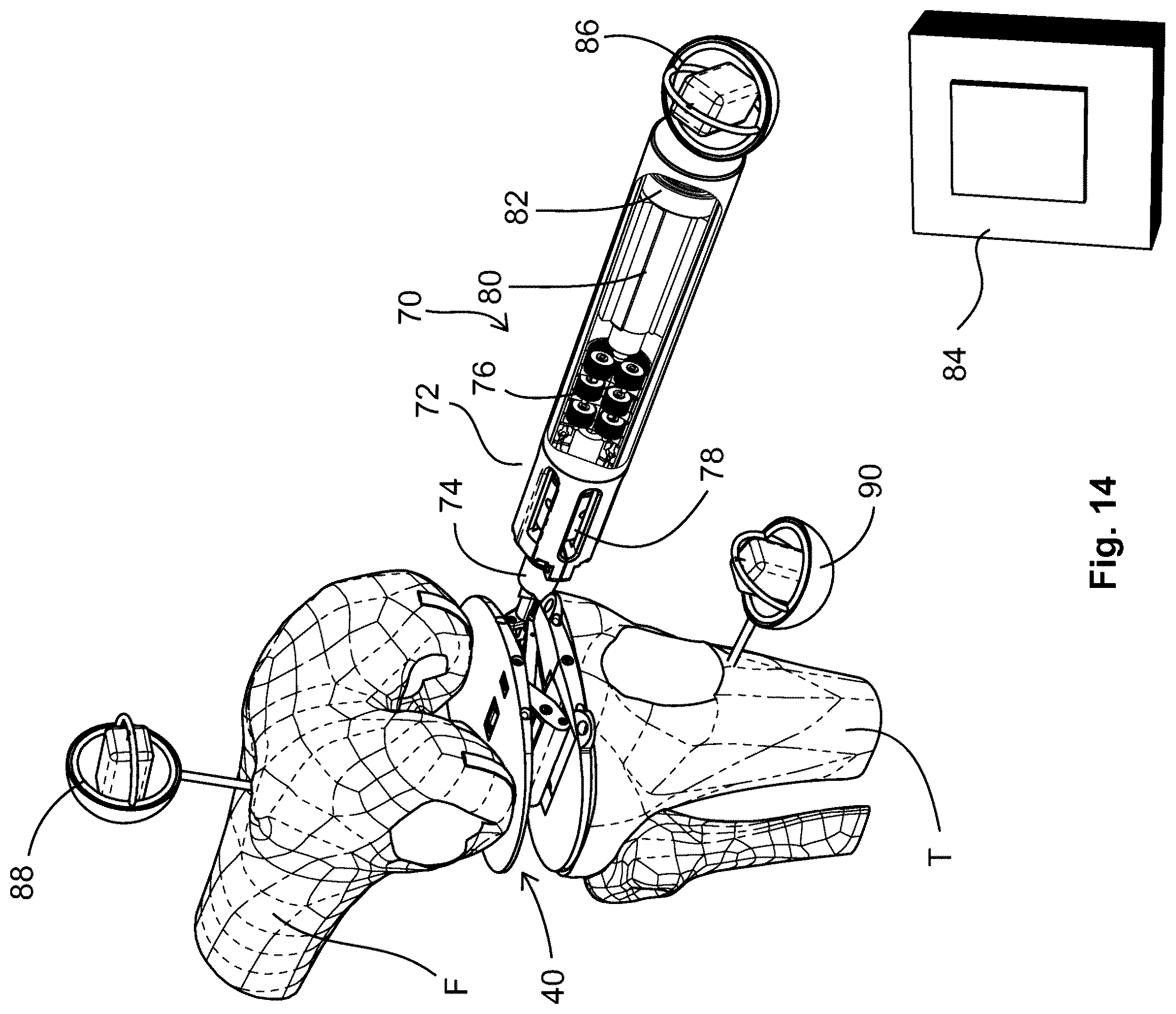 Patent US12599377 Figure 10 – Knee tensioner-balancer and method