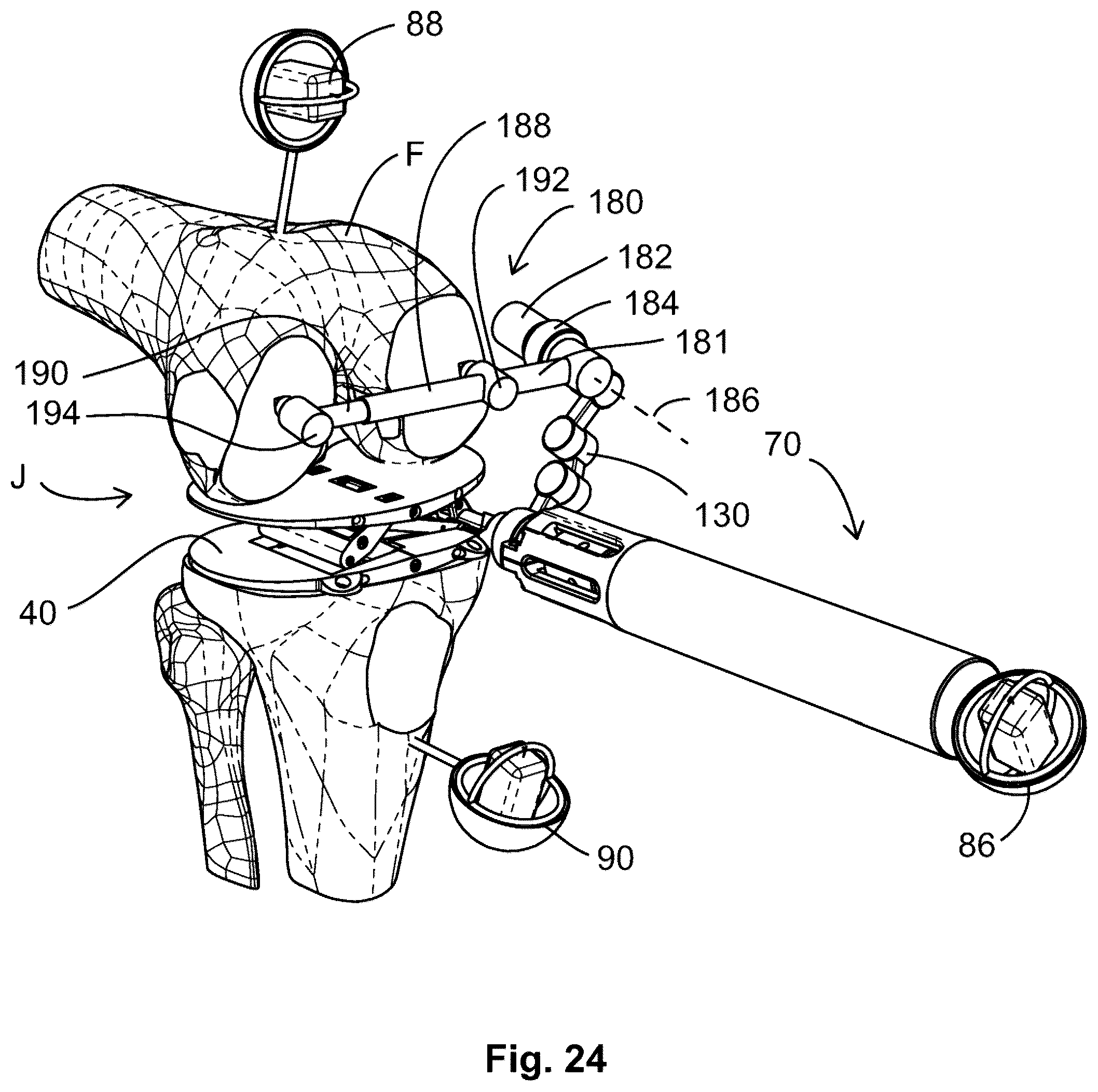 Patent US12599377 Figure 16 – Knee tensioner-balancer and method
