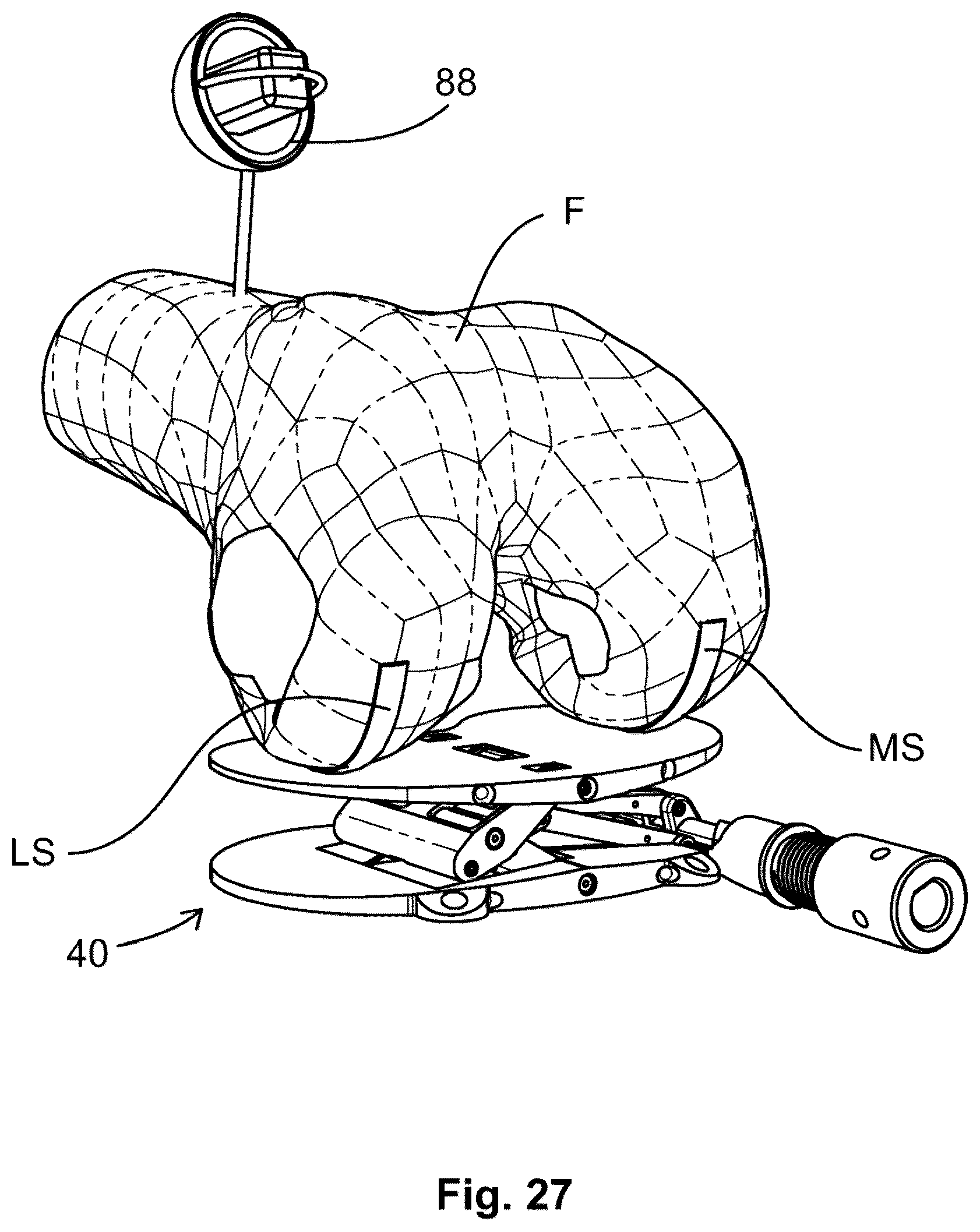 Patent US12599377 Figure 19 – Knee tensioner-balancer and method