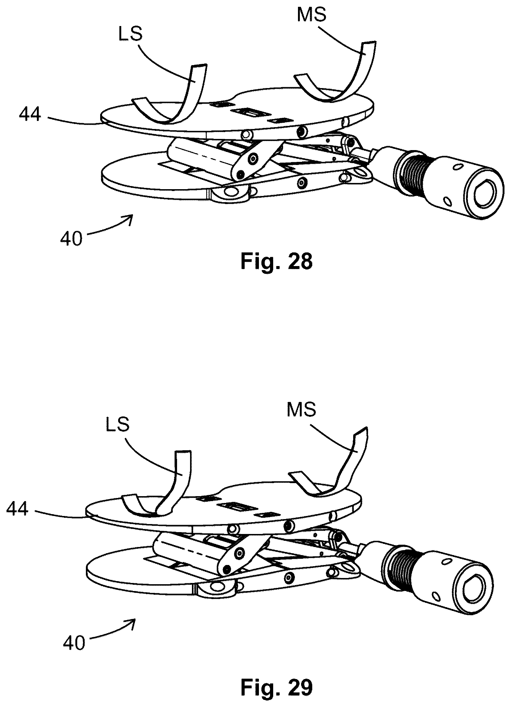 Patent US12599377 Figure 20 – Knee tensioner-balancer and method
