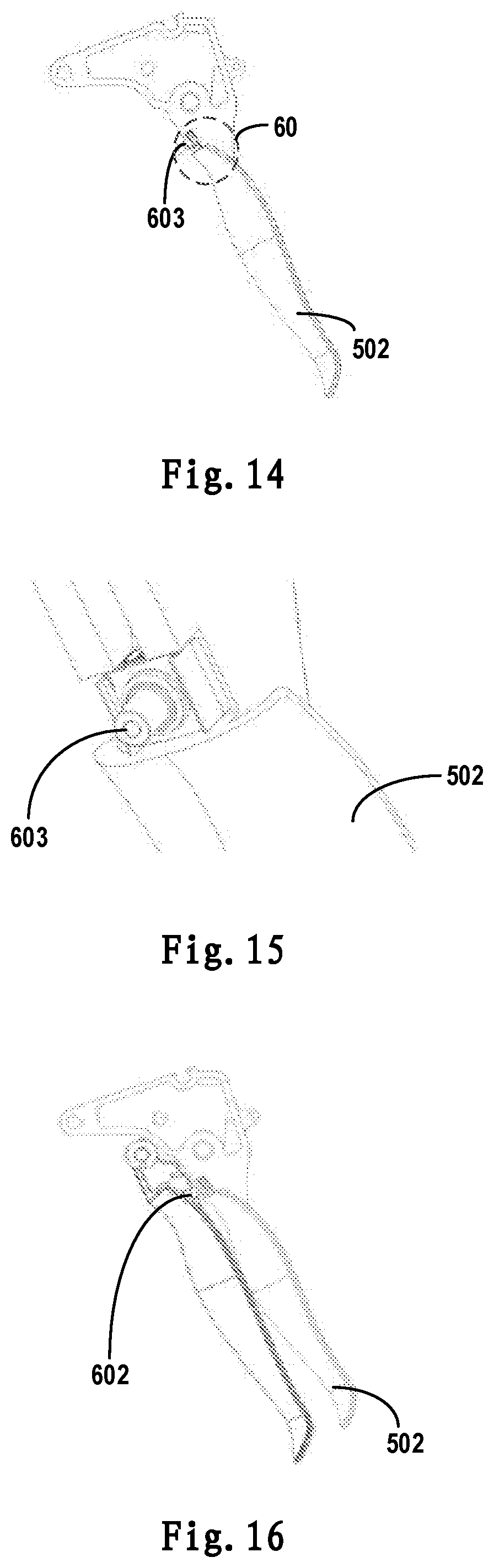 Patent US12599380 Figure 17 – Surgical stapler and staple cartridge for the same