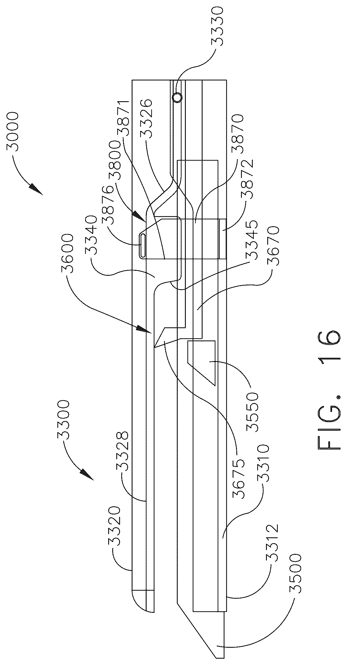 Patent US12599382 Figure 14 – Staple cartridge comprising formation support features