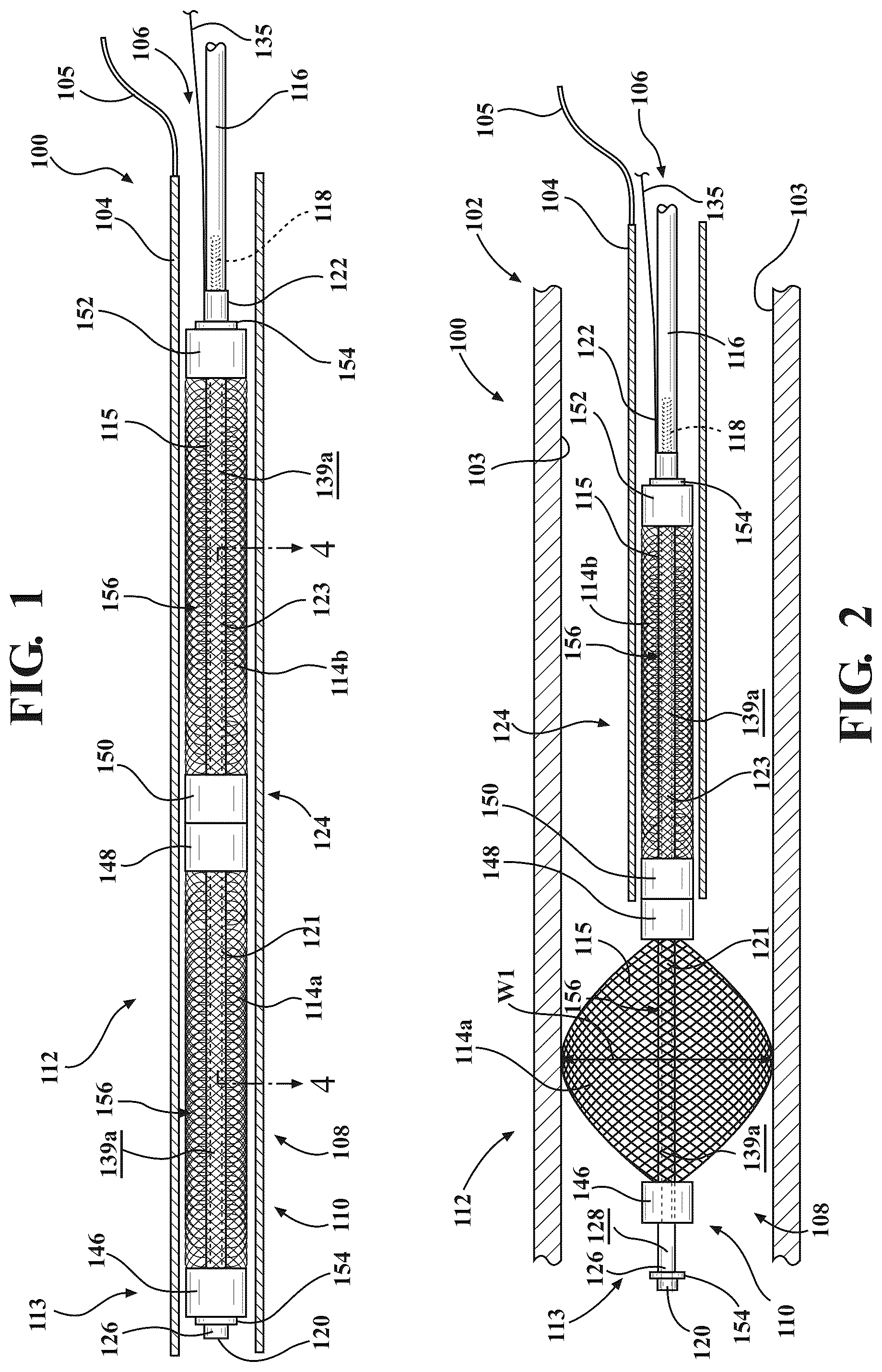 Patent US12599384 Figure 1 – Occlusion devices and methods of use thereof