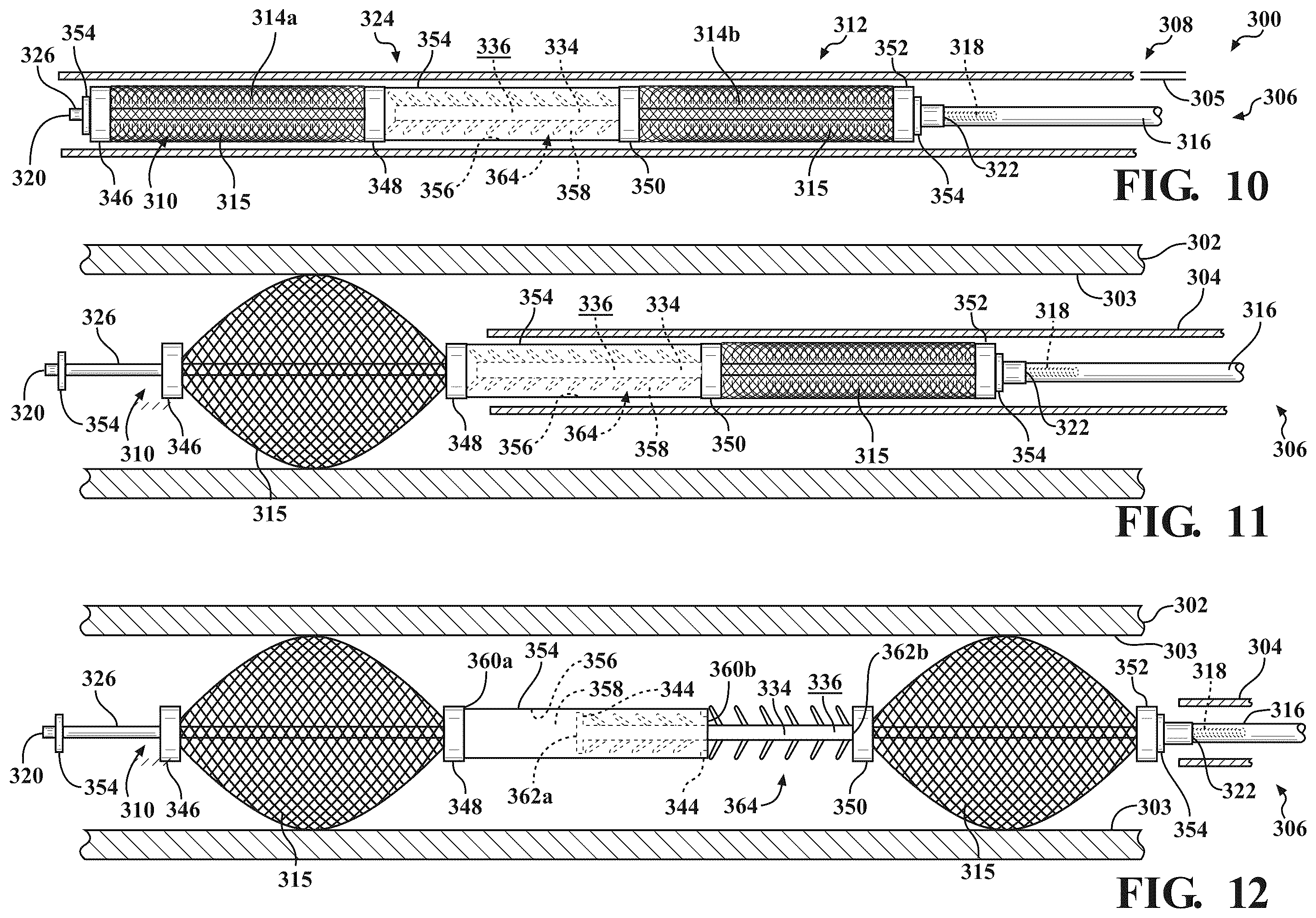 Patent US12599384 Figure 6 – Occlusion devices and methods of use thereof
