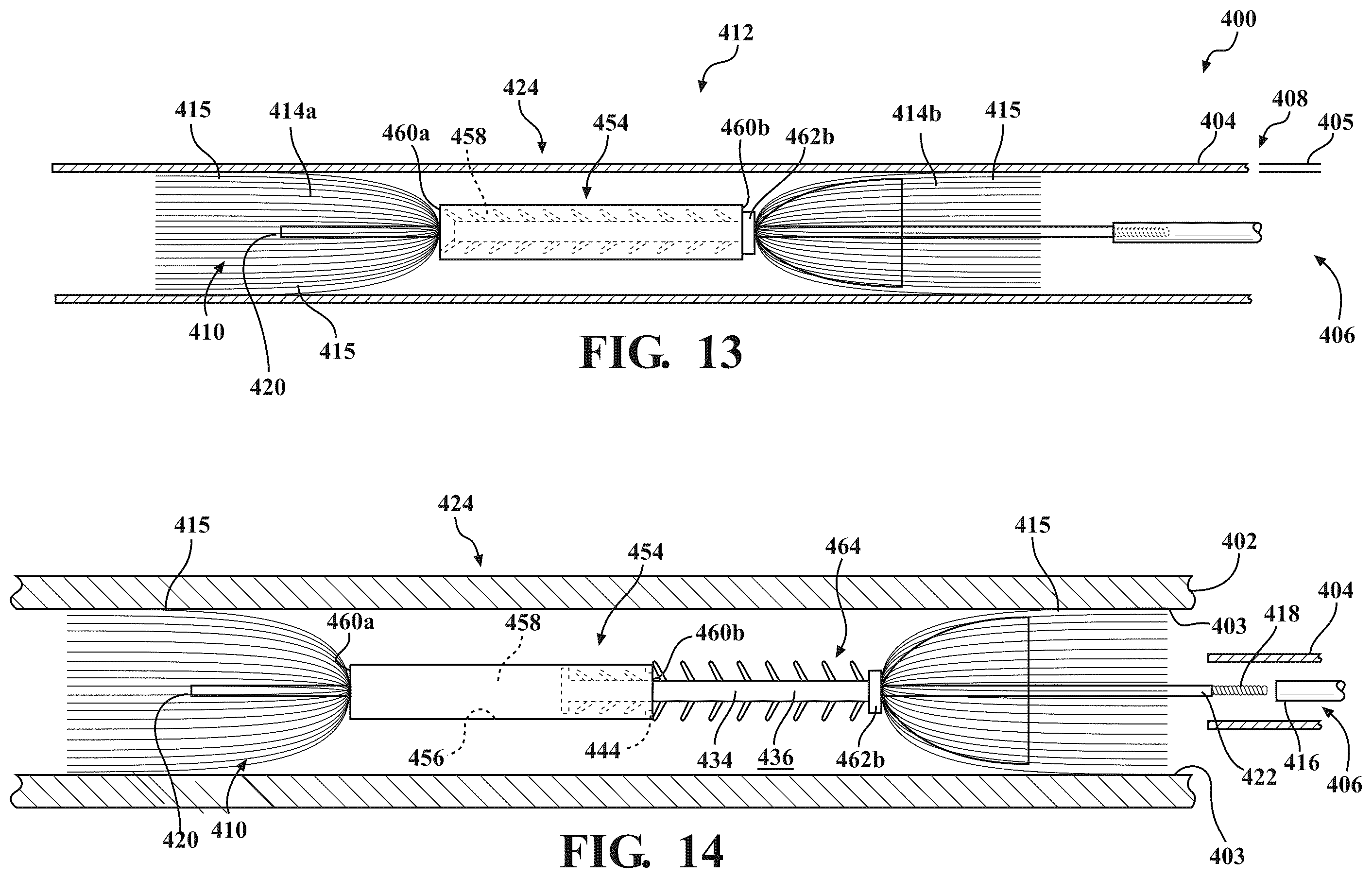 Patent US12599384 Figure 7 – Occlusion devices and methods of use thereof