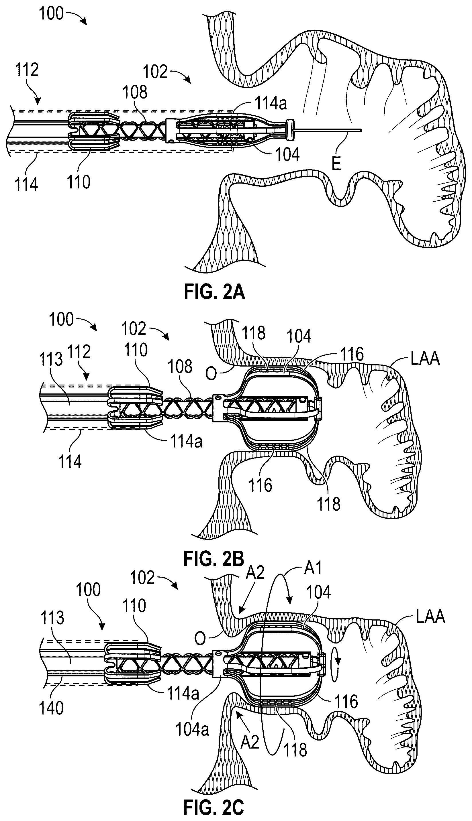 Patent US12599386 Figure 2 – Devices, systems, and methods for treating the left atrial appendage