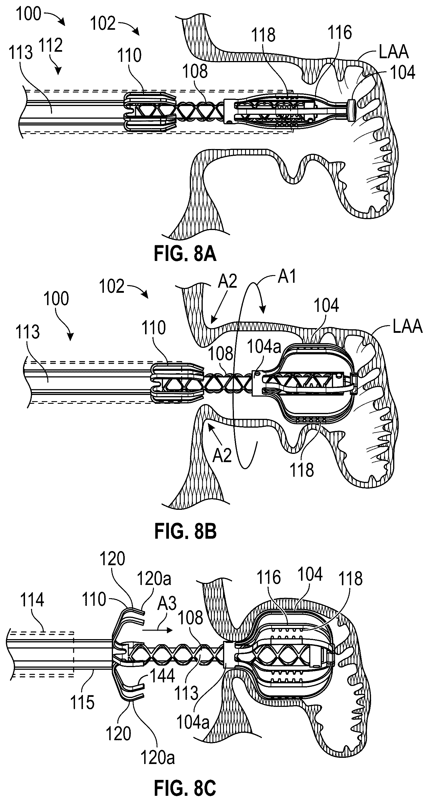 Patent US12599386 Figure 6 – Devices, systems, and methods for treating the left atrial appendage