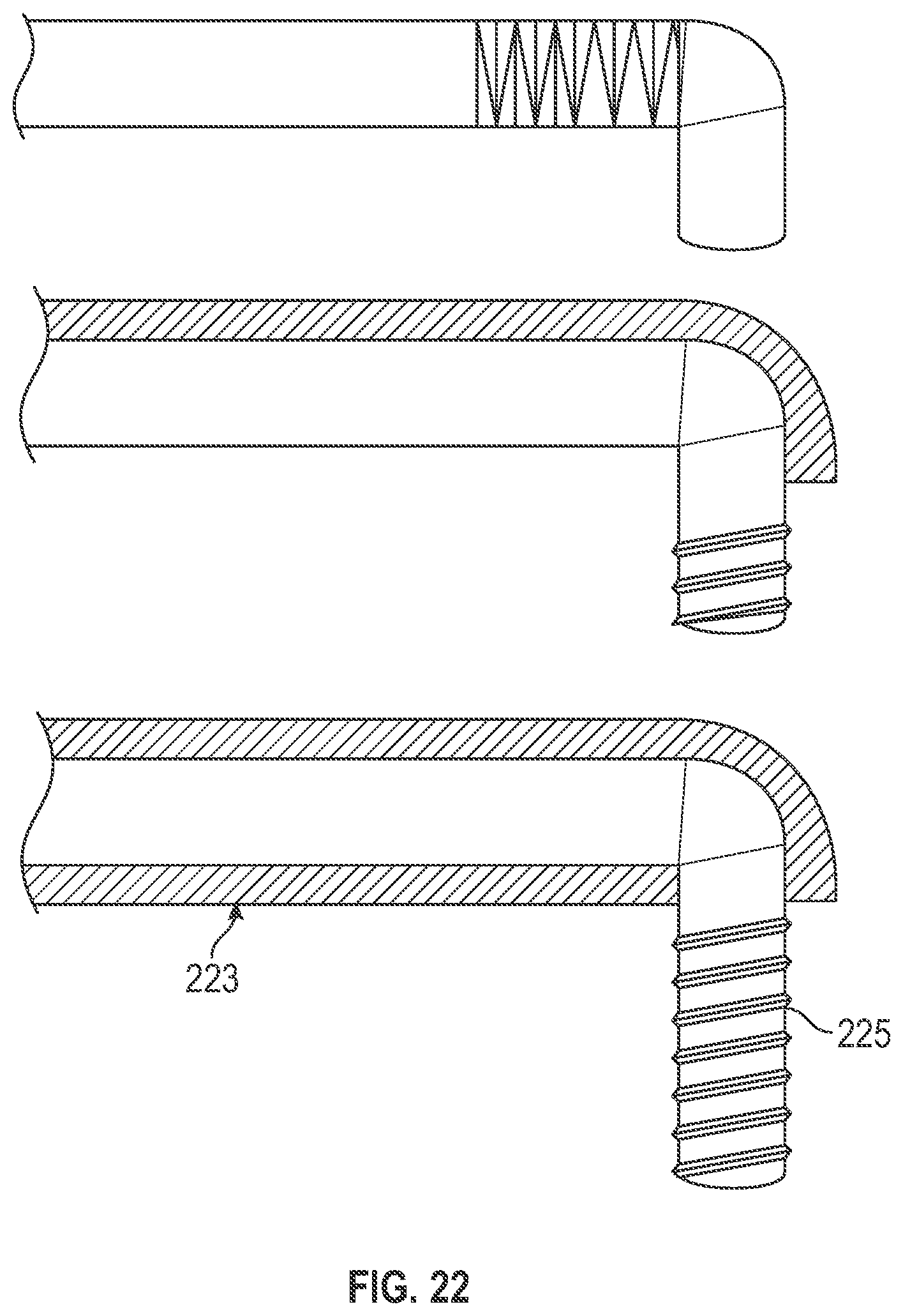 Patent US12599388 Figure 16 – Bone graft delivery devices and method