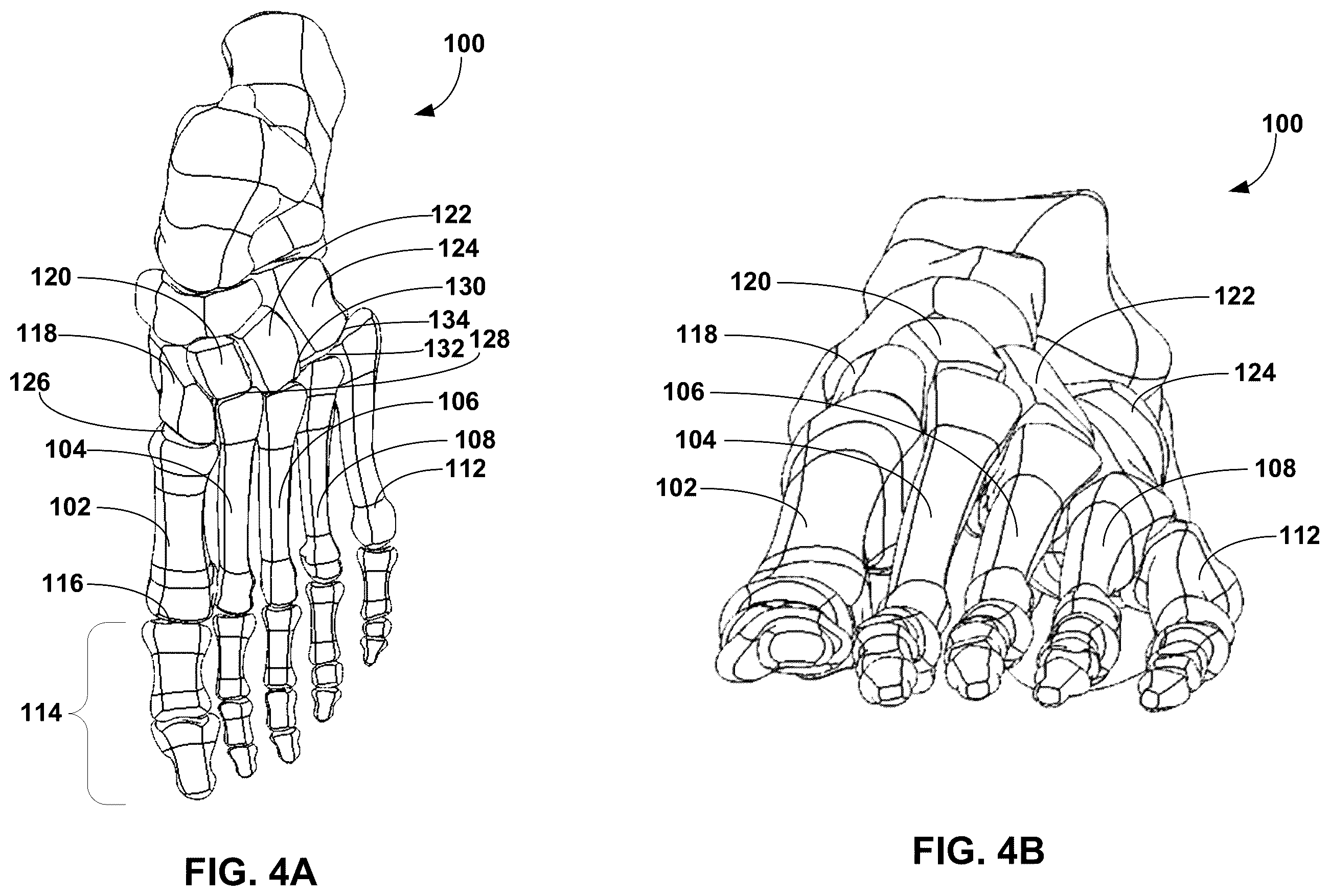 Patent US12599389 Figure 6 – Multi-sided cutting instrument for mobilizing small bones in the foot