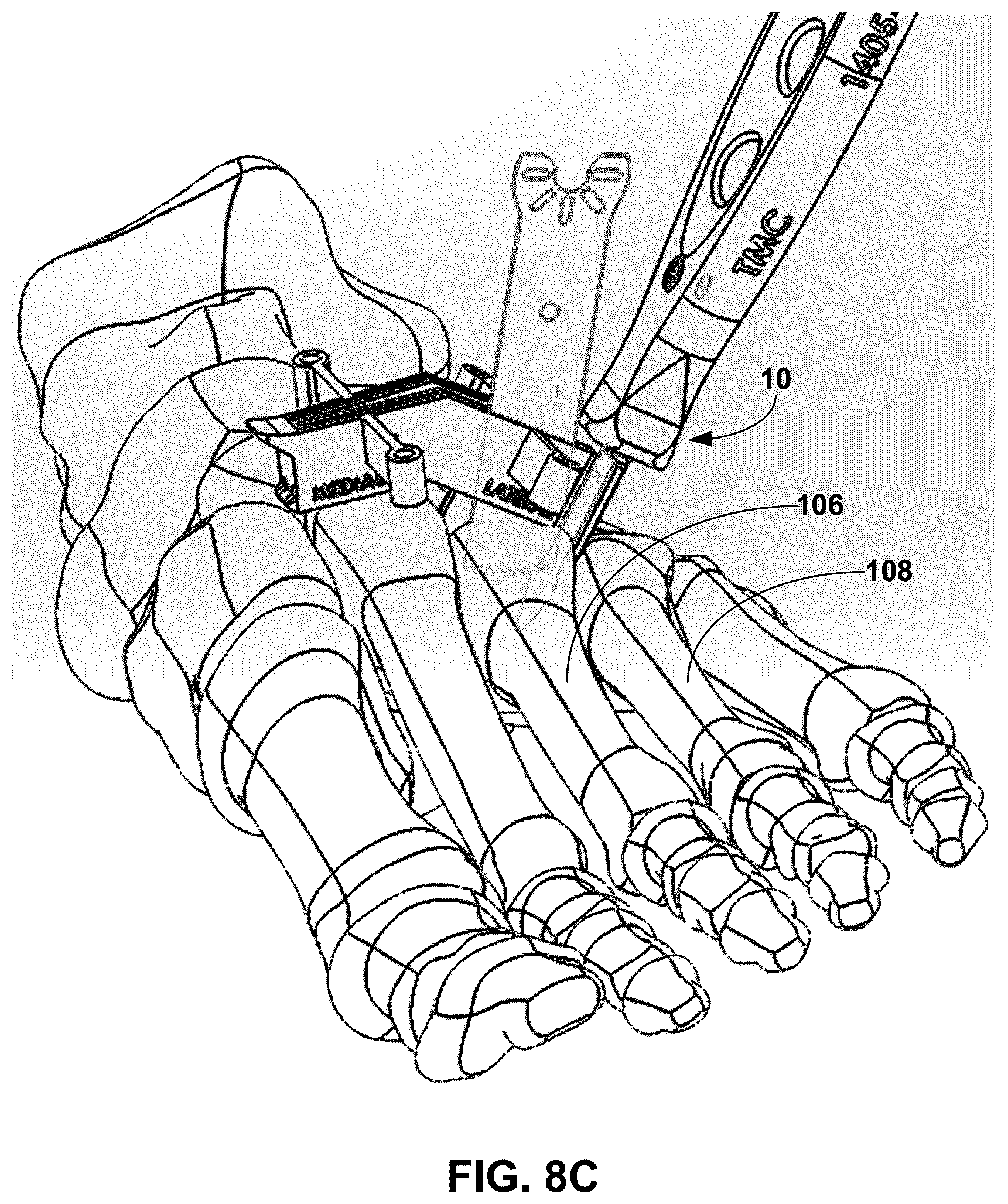 Patent US12599389 Figure 16 – Multi-sided cutting instrument for mobilizing small bones in the foot