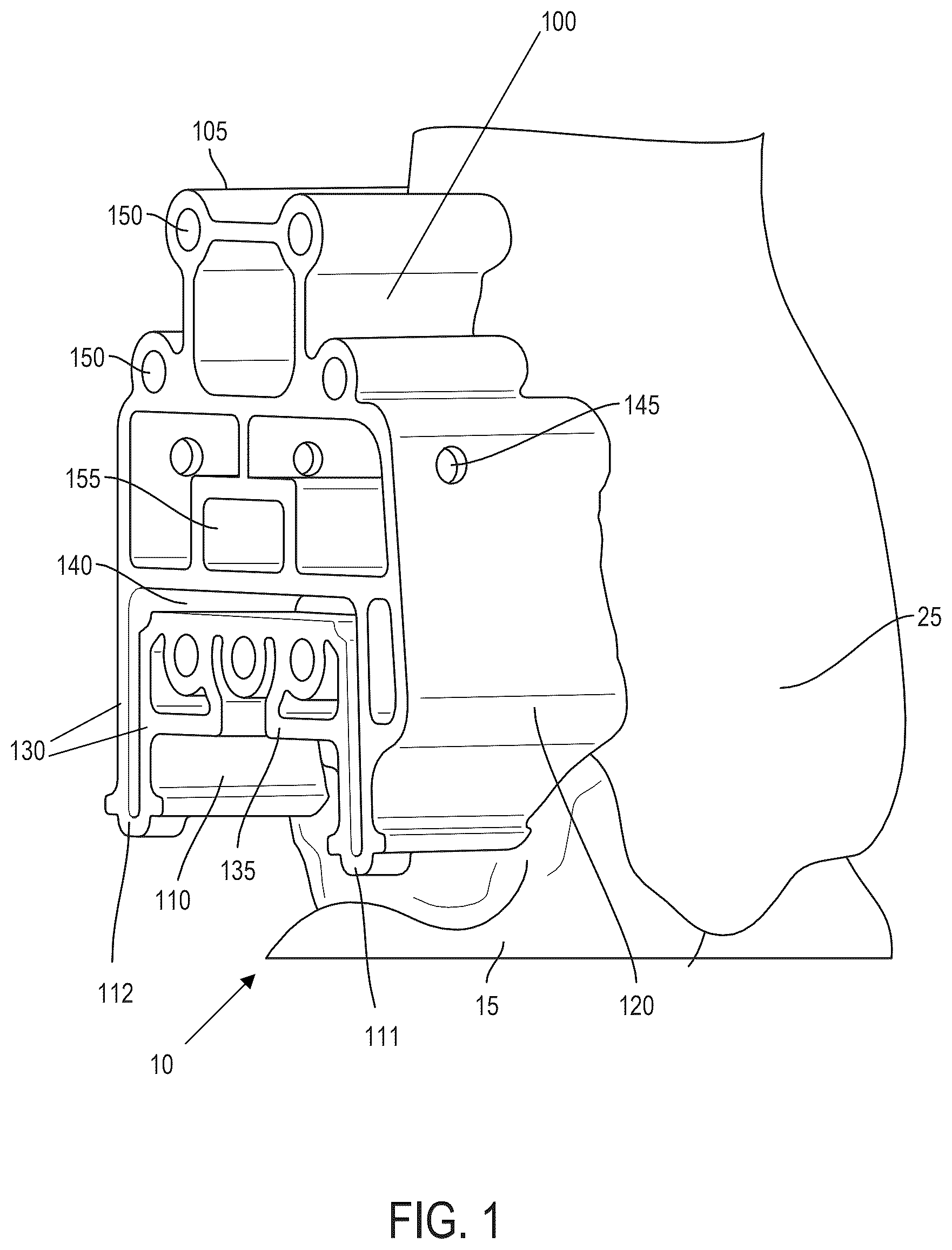Patent US12599390 Figure 1 – Surgical guides and processes for producing and using the same