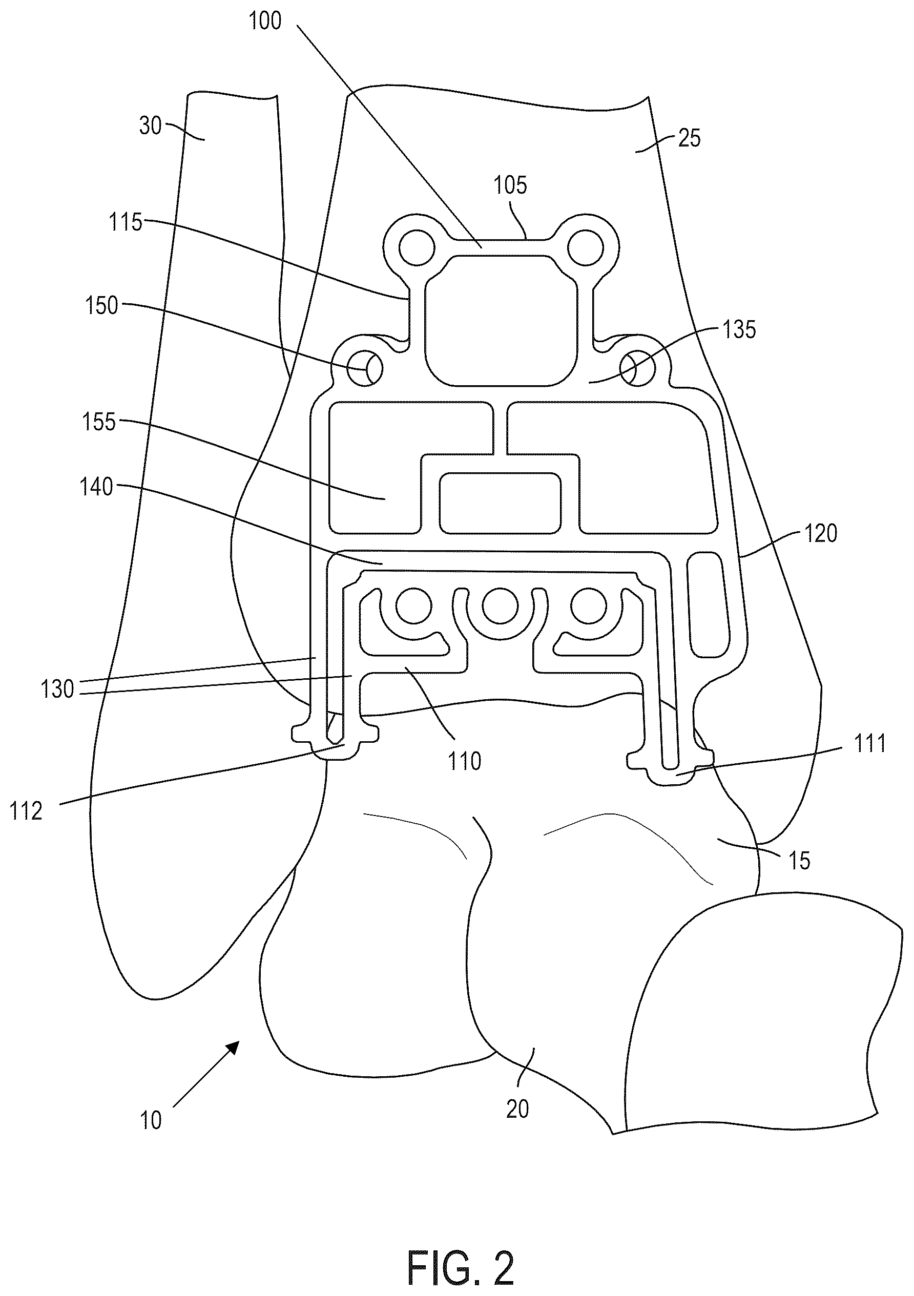 Patent US12599390 Figure 2 – Surgical guides and processes for producing and using the same