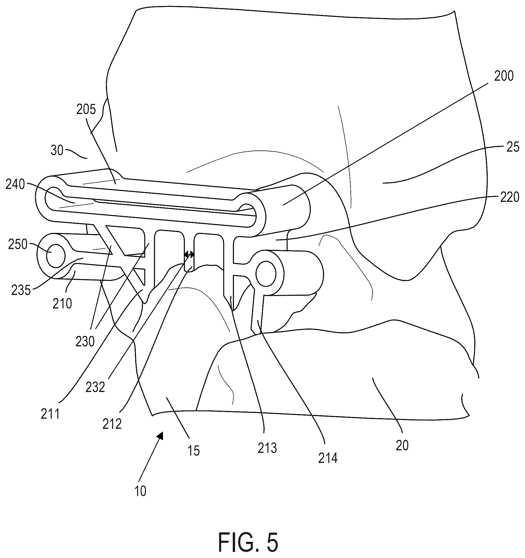 Patent US12599390 Figure 5 – Surgical guides and processes for producing and using the same