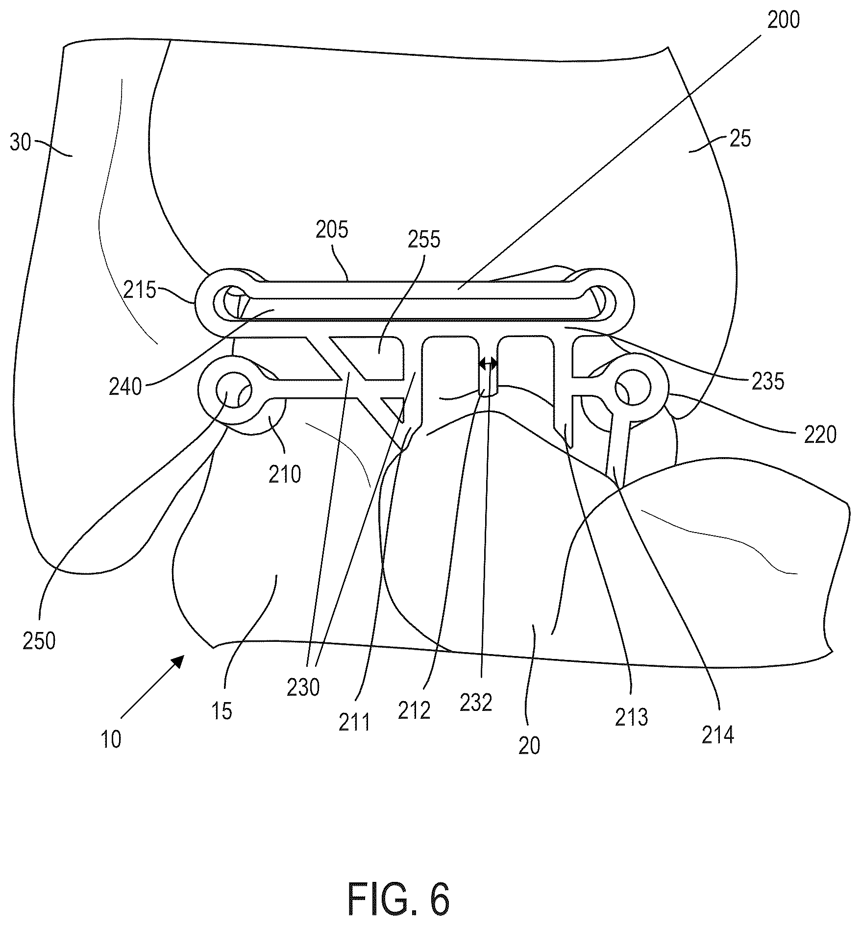 Patent US12599390 Figure 6 – Surgical guides and processes for producing and using the same