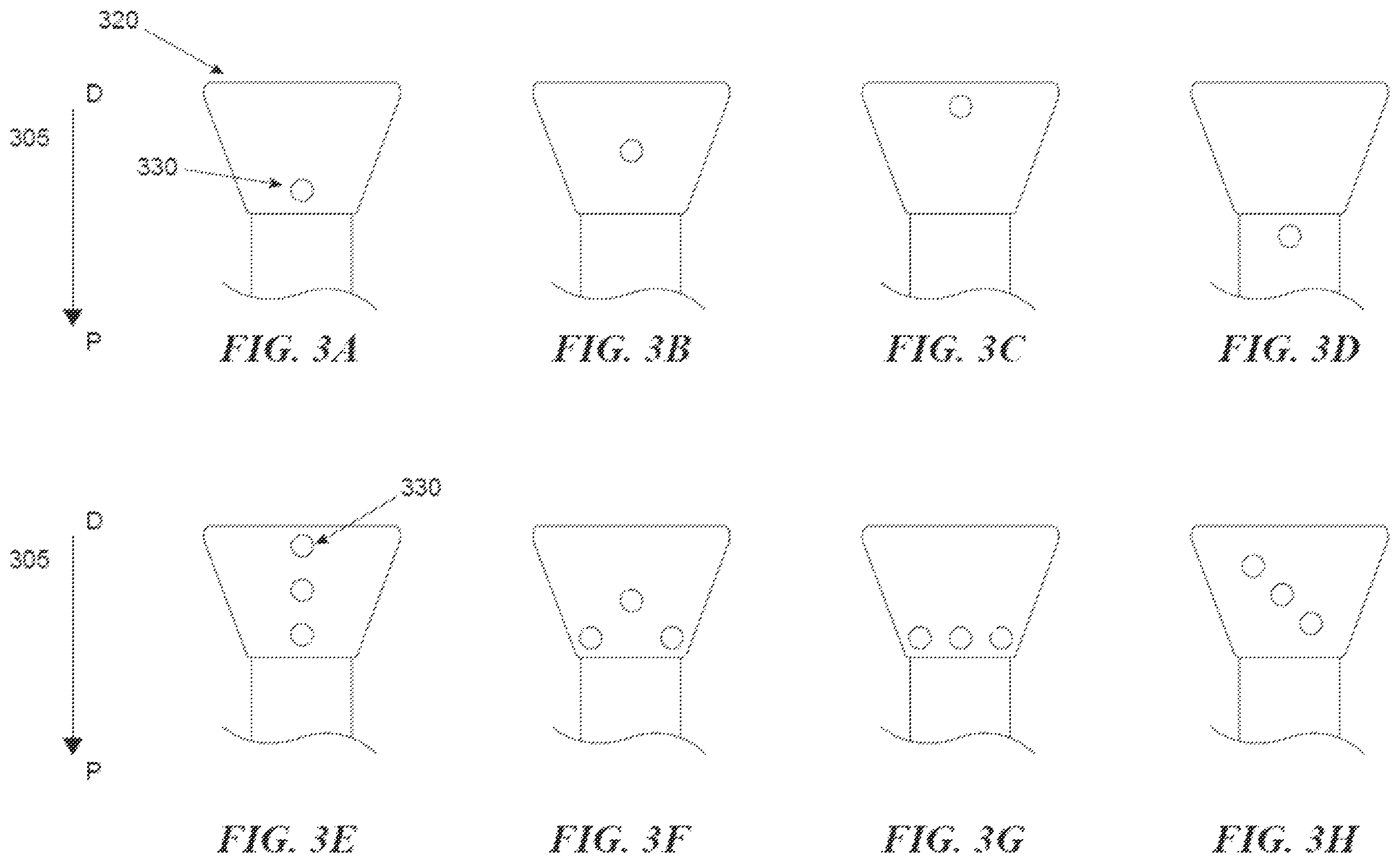 Patent US12599397 Figure 4 – Thrombus removal systems and associated methods