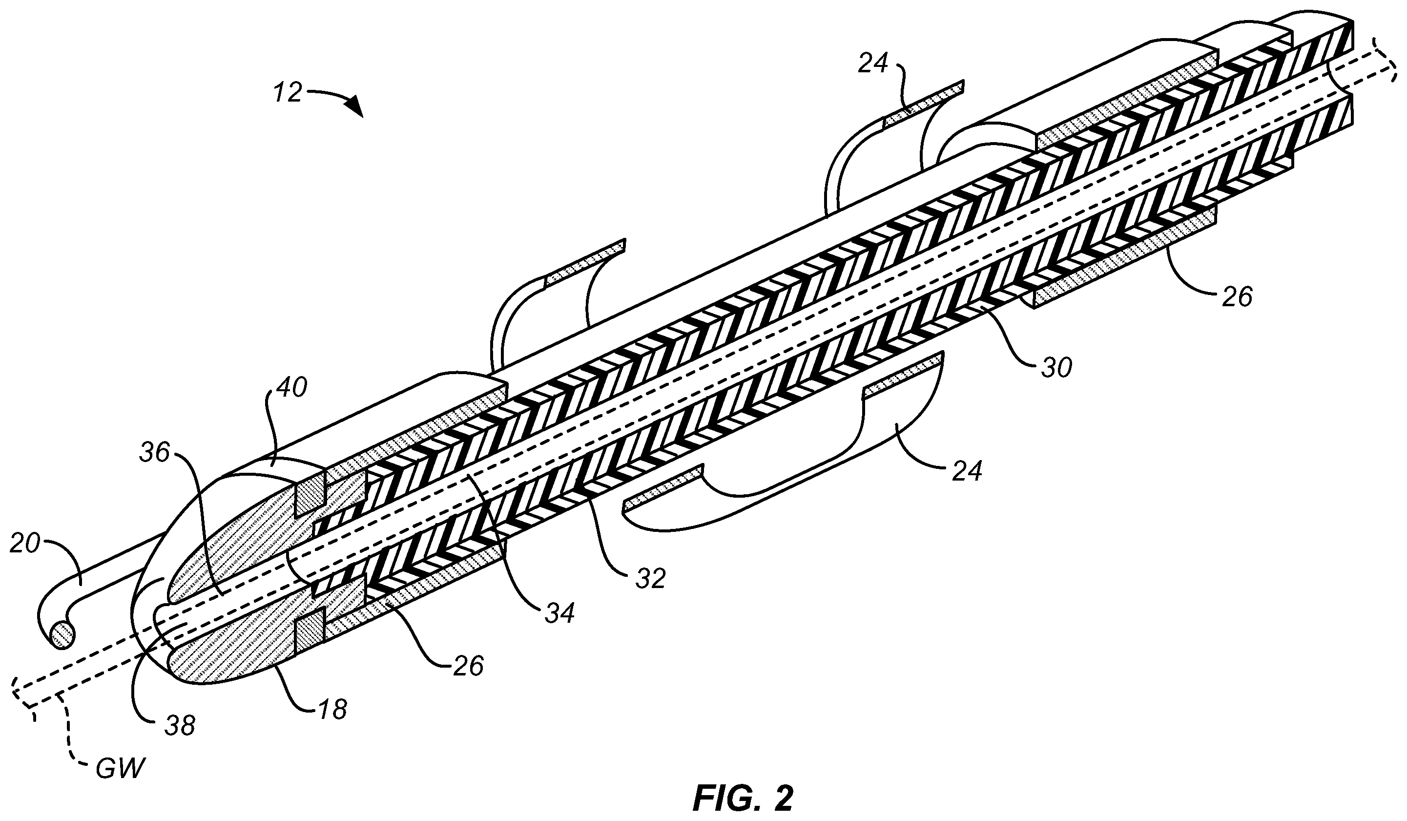 Patent US12599398 Figure 2 – Device and method for centering and crossing a vascular occlusion