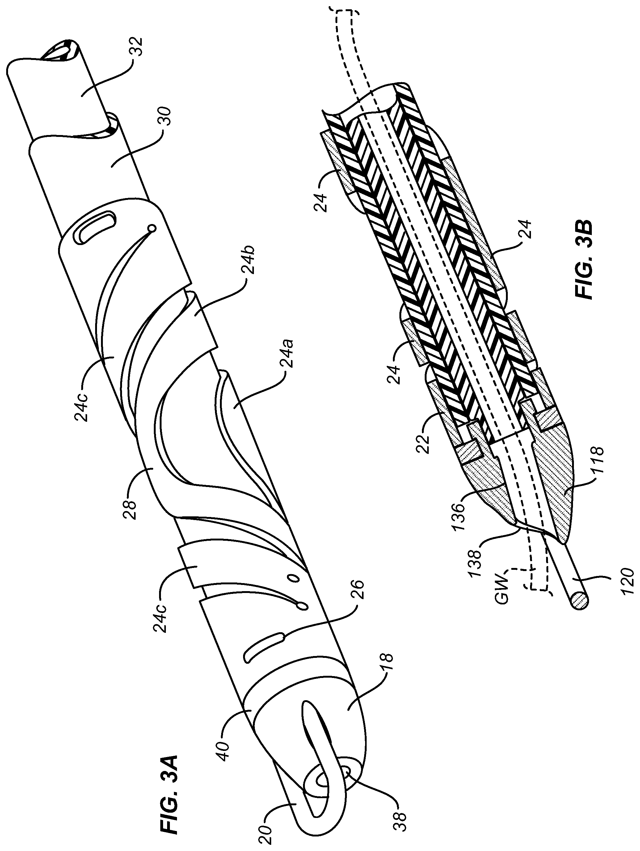Patent US12599398 Figure 3 – Device and method for centering and crossing a vascular occlusion