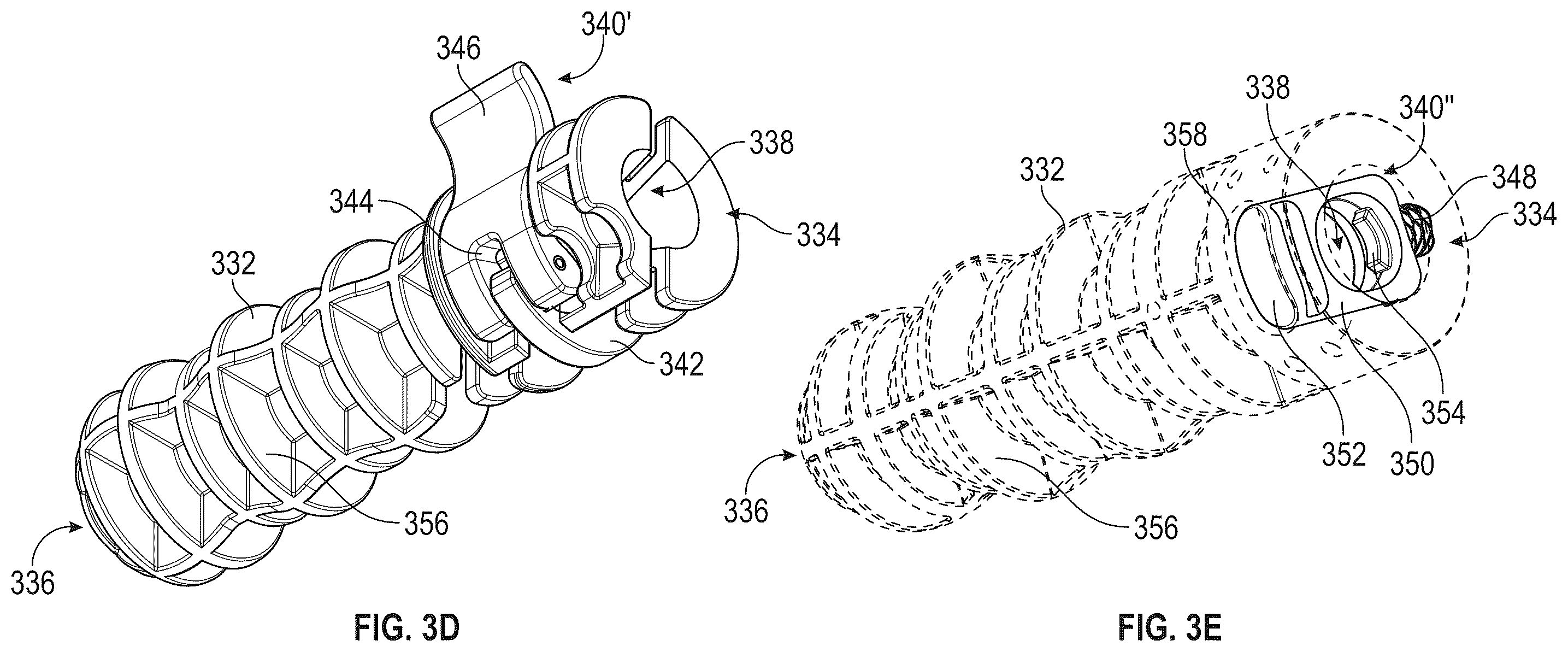 Patent US12599400 Figure 6 – Surgical kit for spinal decompression to treat spinal stenosis