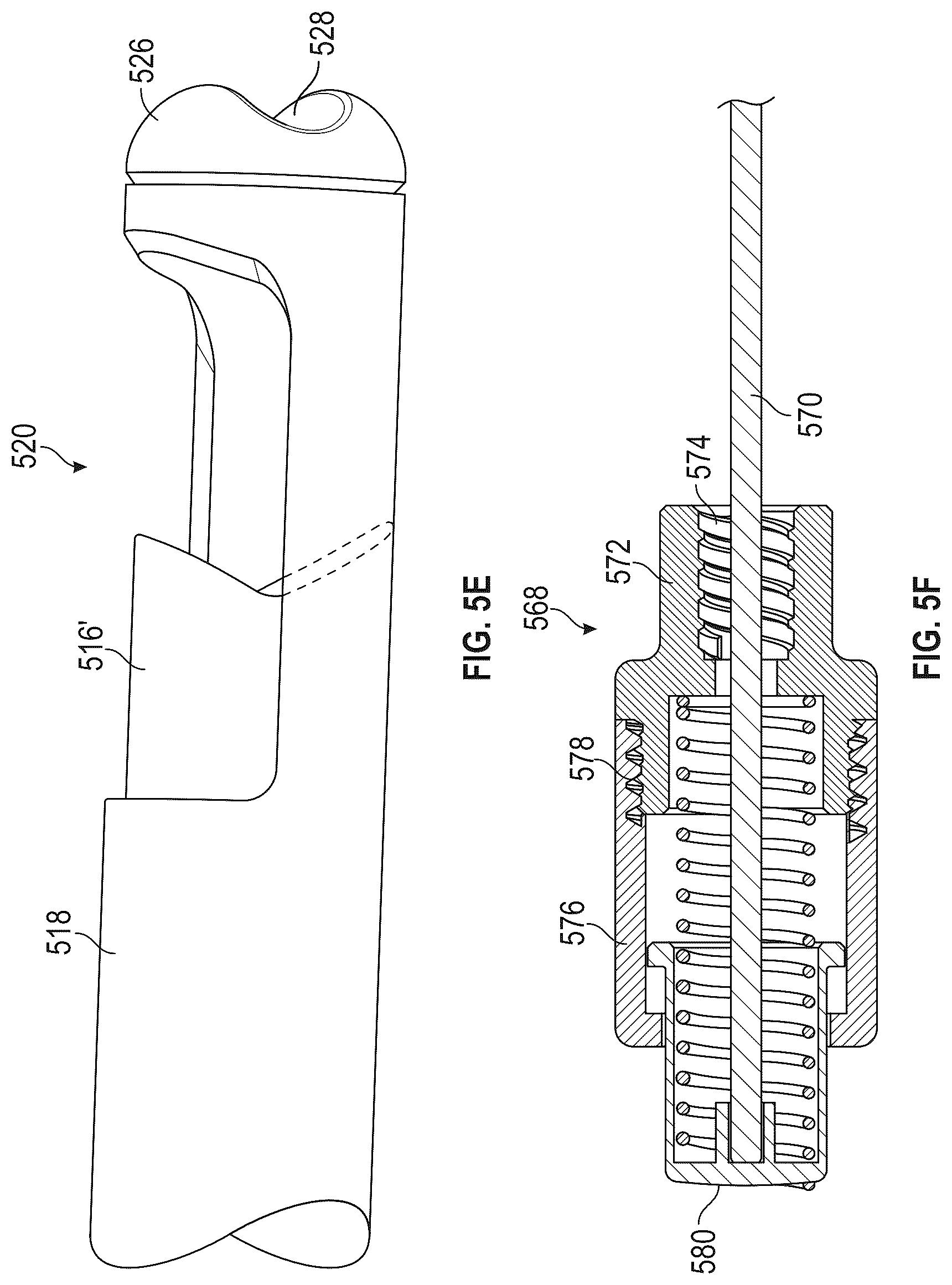 Patent US12599400 Figure 13 – Surgical kit for spinal decompression to treat spinal stenosis