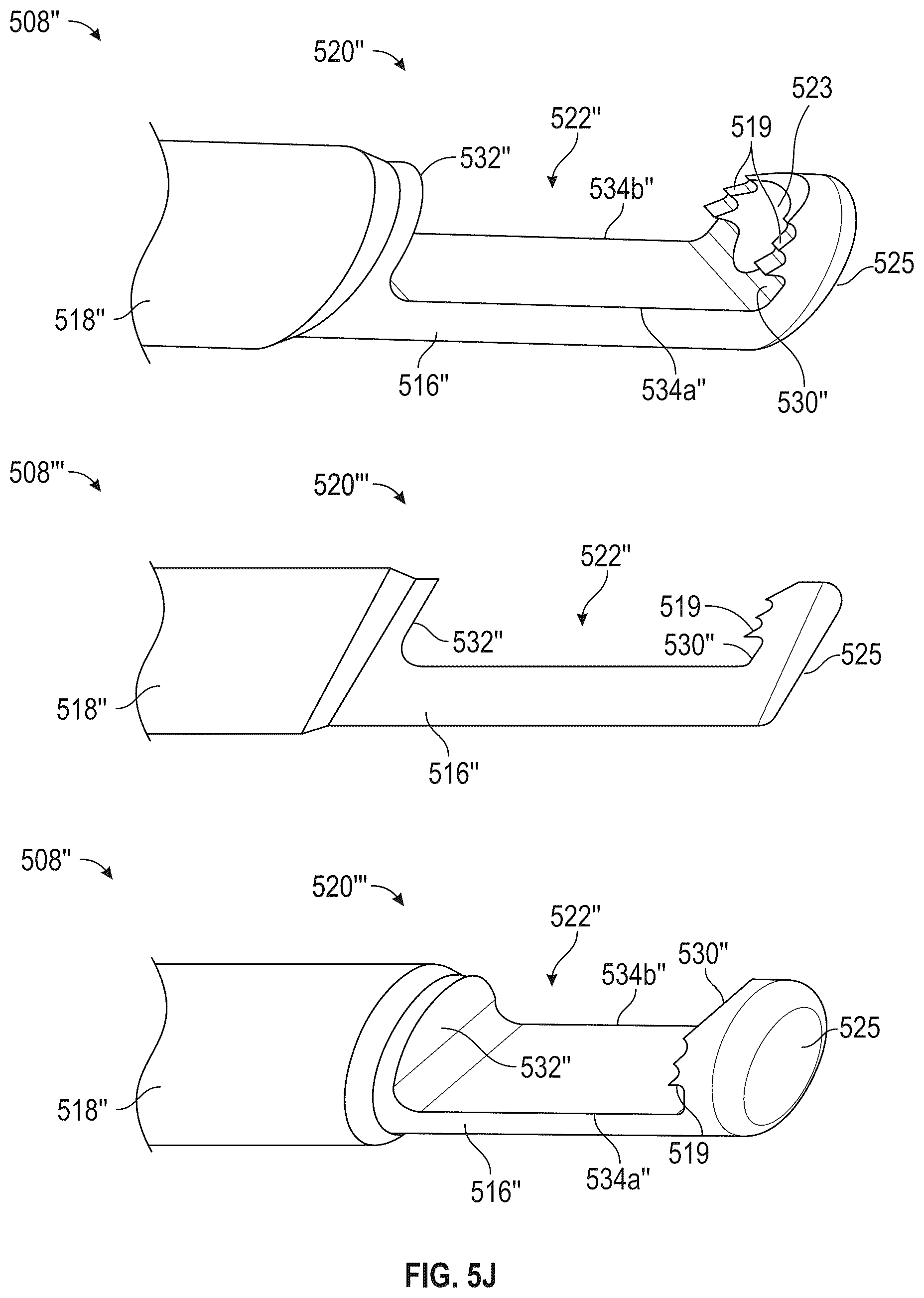 Patent US12599400 Figure 17 – Surgical kit for spinal decompression to treat spinal stenosis