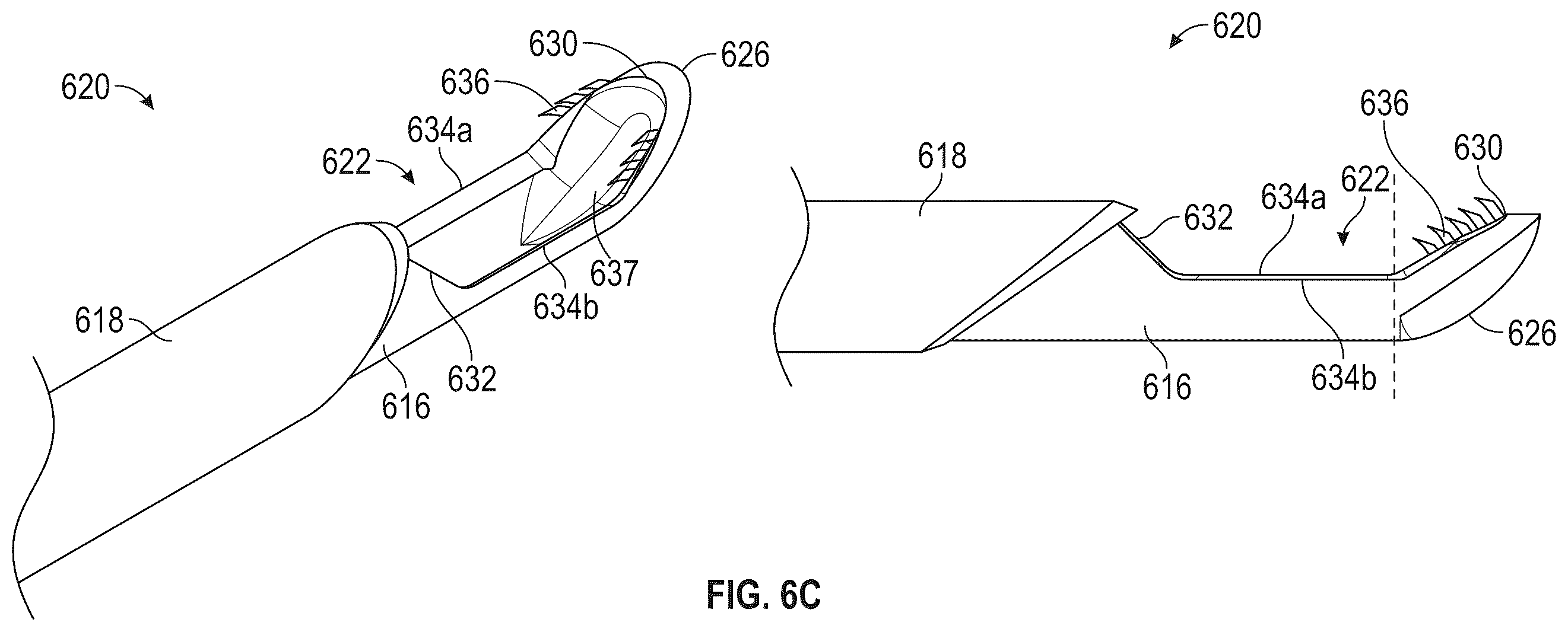 Patent US12599400 Figure 20 – Surgical kit for spinal decompression to treat spinal stenosis